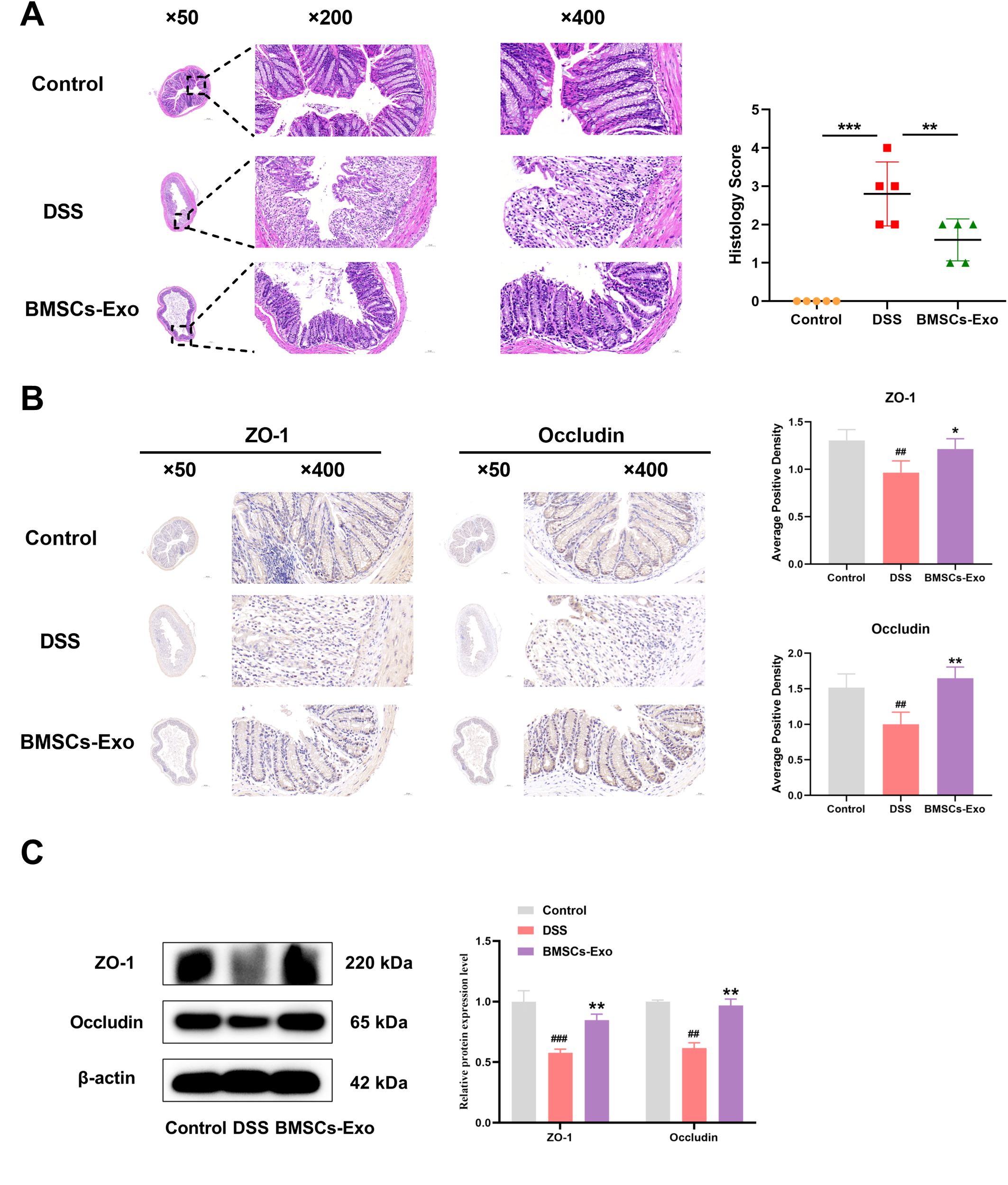 Panel A shows histological images of colon tissue at different magnifications (x50, x200, x400) for Control, DSS, and BMSCs-Exo groups, with a bar graph comparing histology scores. Panel B presents ZO-1 and Occludin staining at x50 and x400 magnifications for the same groups, alongside bar graphs for average positive density. Panel C includes Western blot results for ZO-1, Occludin, and β-actin, with a bar graph showing relative protein expression levels for Control, DSS, and BMSCs-Exo groups.