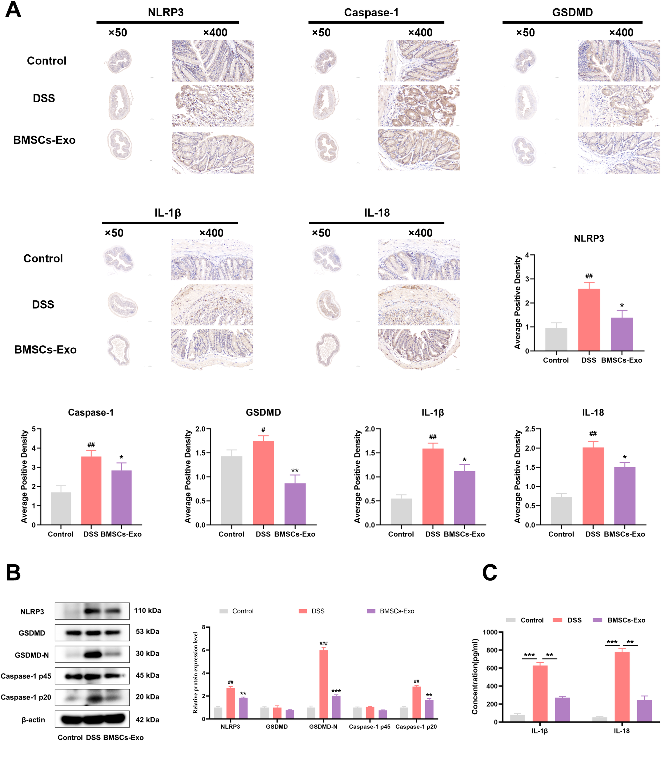 Panel A shows histological sections stained for NLRP3, Caspase-1, GSDMD, IL-1β, and IL-18 at magnifications of 50x and 400x under Control, DSS, and BMSCs-Exo conditions. Bar graphs display average positive densities for each staining. Panel B depicts Western blot results for NLRP3, GSDMD, Caspase-1, and β-actin with quantitative bar graphs comparing protein expressions across groups. Panel C presents bar graphs indicating IL-1β and IL-18 concentrations, highlighting significant differences among Control, DSS, and BMSCs-Exo groups.