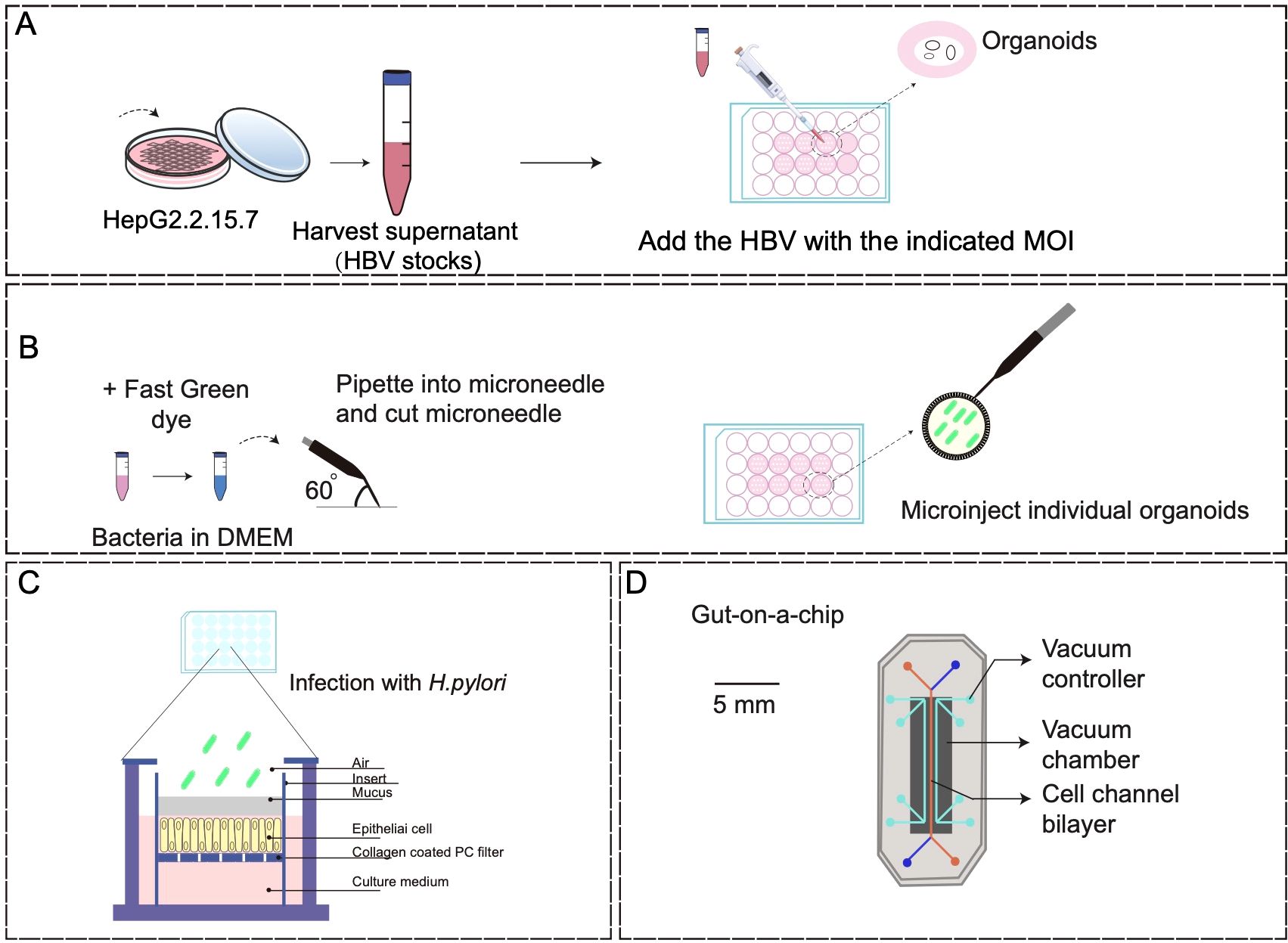 Diagram illustrating the steps for conducting an experiment with HepG2.2.15.7 cells, bacteria, and a gut-on-a-chip system. (A) Shows harvesting HBV stocks and adding them to organoids. (B) Demonstrates preparing bacteria in DMEM, adding Fast Green dye, and using a microneedle to microinject organoids. (C) Depicts an infection process with H. pylori involving an epithelial cell culture setup. (D) Illustrates a gut-on-a-chip device with a vacuum controller, vacuum chamber, and cell channel bilayer. The diagram is divided into four panels labeled A to D.