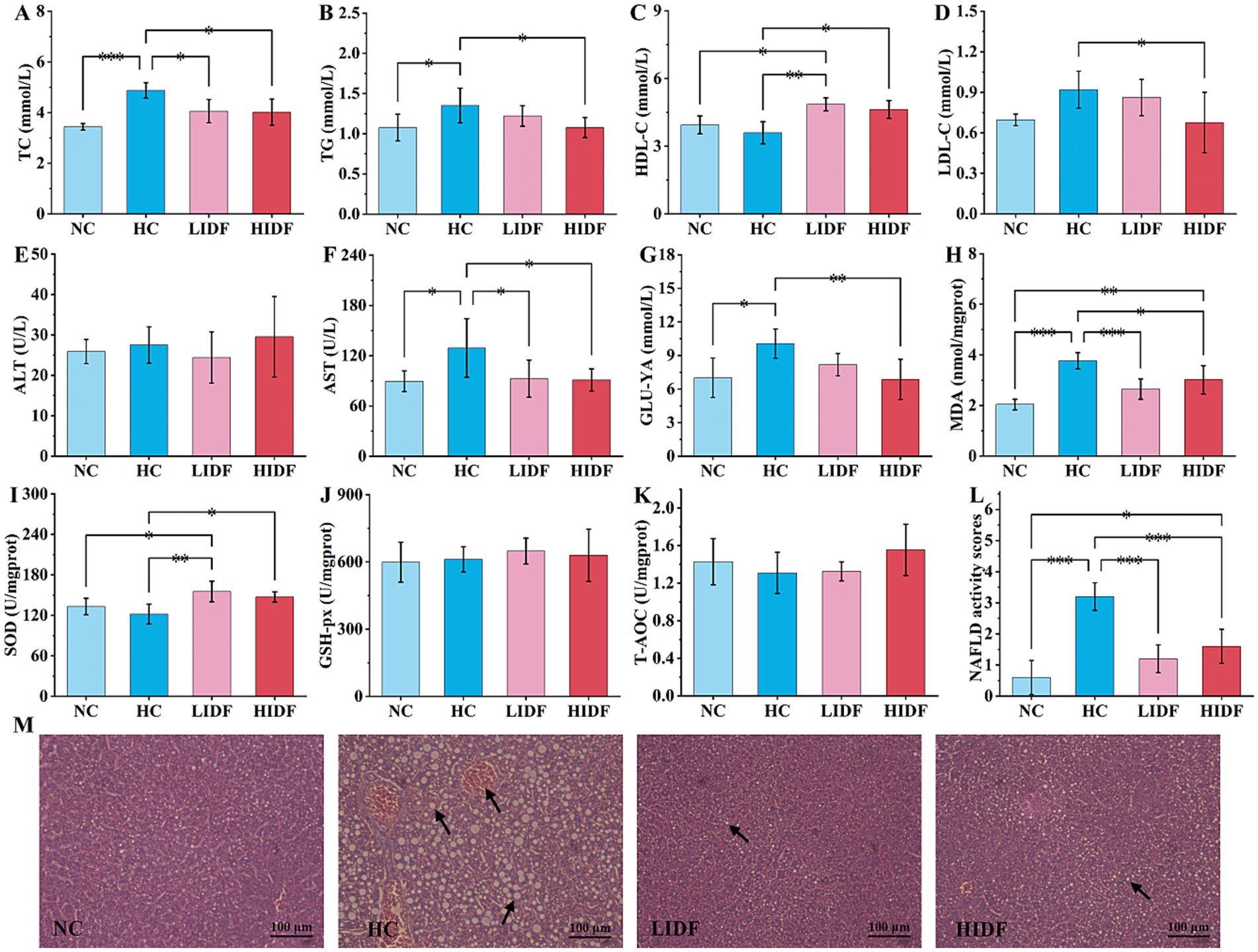 Graphs A to L show various biochemical parameters for different groups: NC, HC, LIDF, and HIDF. Parameters include TC, TG, HDL-C, LDL-C, ALT, AST, GLU-γA, MDA, SOD, GSH-Px, T-AOC, and NAFLD activity scores with significant differences marked. Panel M displays histological images of liver tissues from each group, highlighting differences in tissue structure. Black arrows indicate specific features in the HC and LIDF samples.