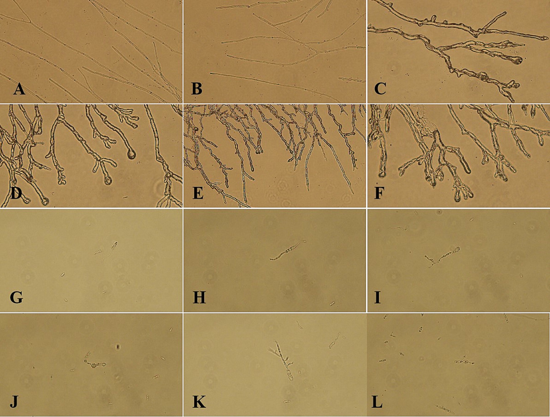 Microscopic images showing fungal structures with different characteristics labeled A to L. Images A, B, and C display long, thread-like hyphae. Images D, E, and F show branching hyphal structures with tree-like patterns. Images G to L depict fewer, smaller, and less defined fungal structures scattered across each frame. The background in all images is a uniform light brown, enhancing the visibility of the fungal formations.