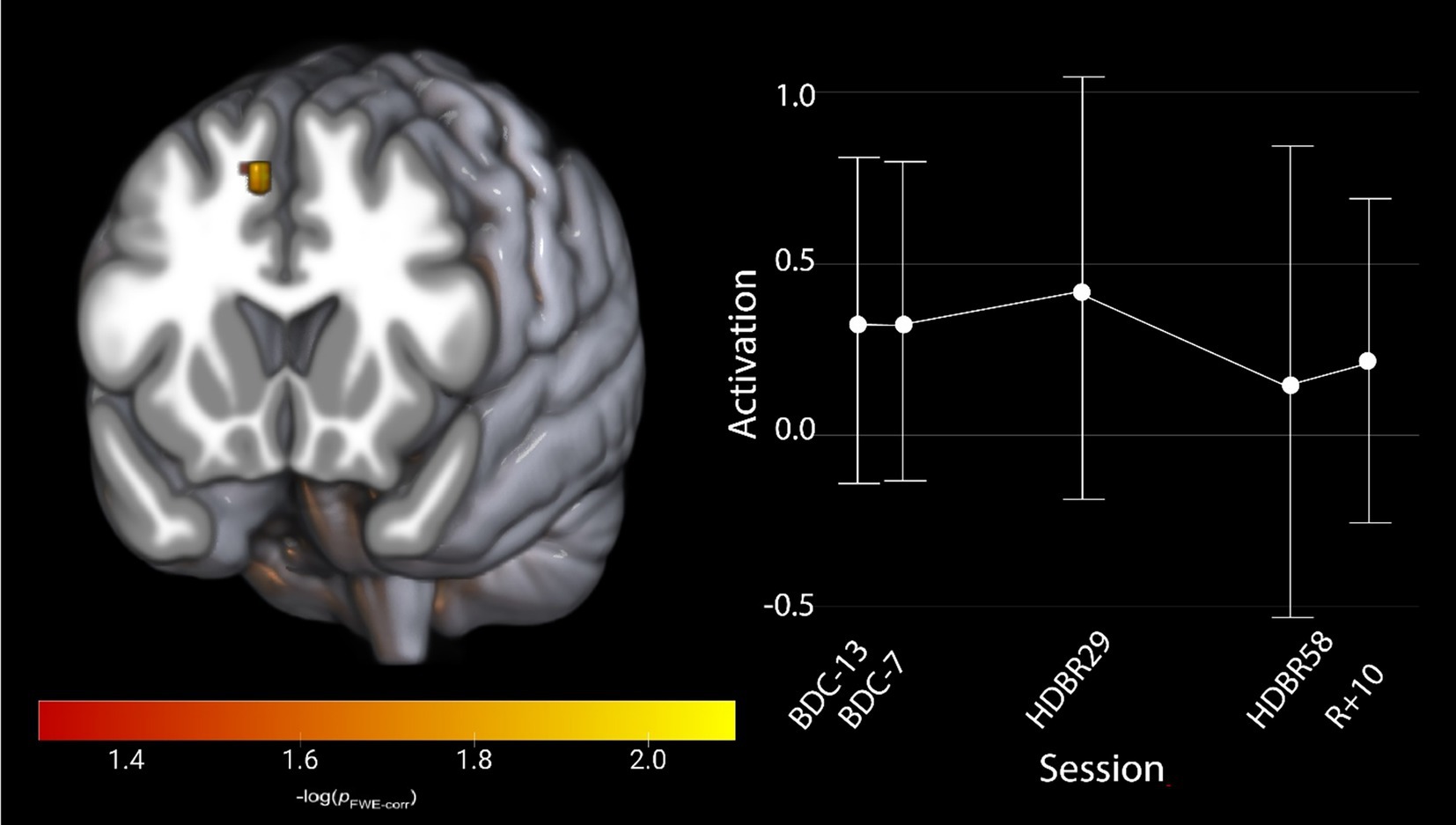 Brain scan highlighting an area of activation in yellow, with a color scale from 1.4 to 2.0. Adjacent graph displays brain activation levels over sessions labeled BDC-13, BDC-7, HDBR29, HDBR58, and R+10, with activation plotted on the y-axis.