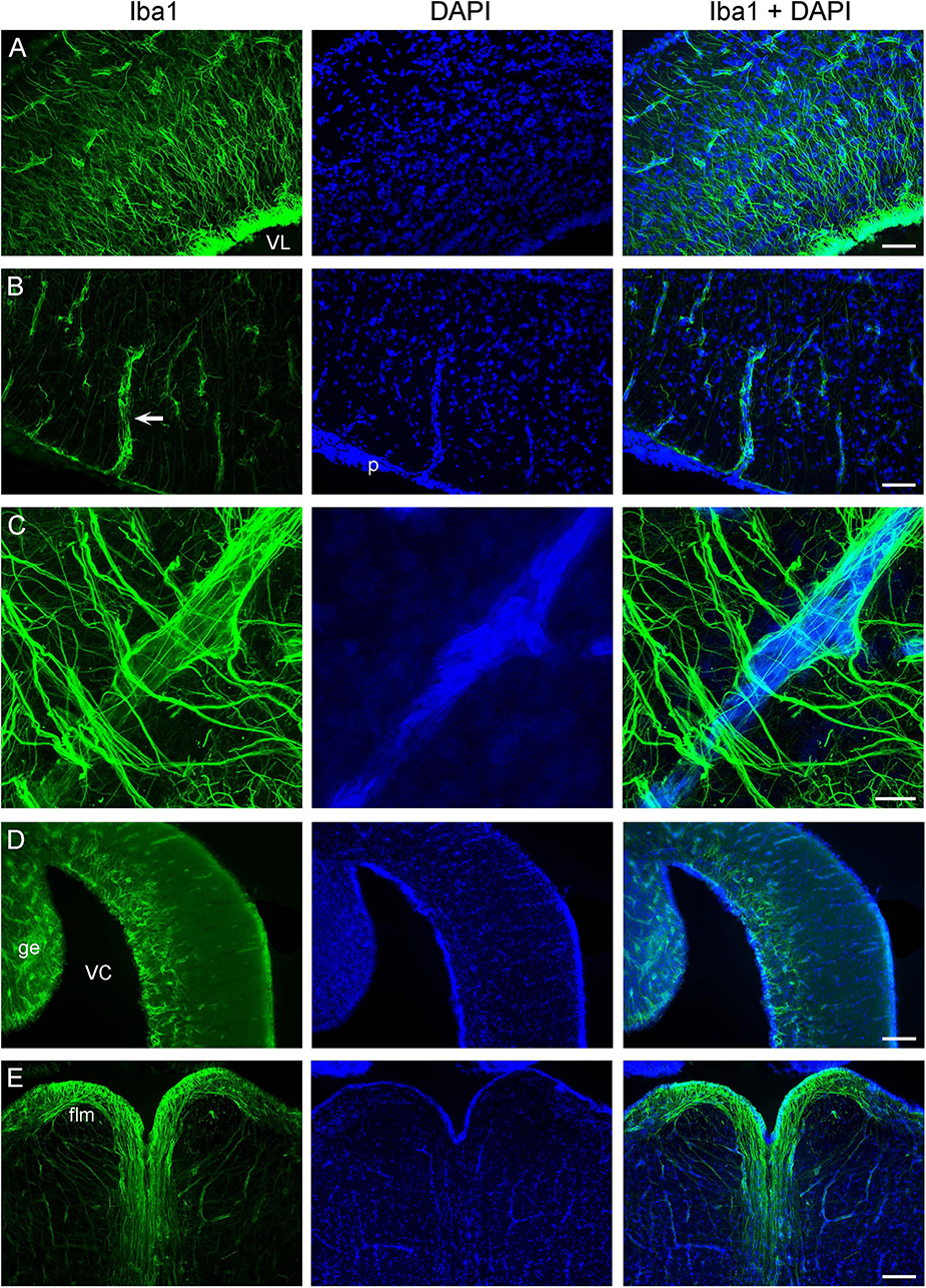 This figure shows angelshark brain sections immunostained for Iba1 (with DAPI as a counterstain) in the telencephalon (panels A-C), the cerebellum (panel D), and the myelencephalon (panel E).