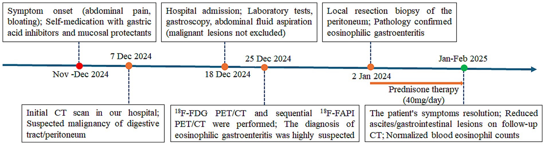 Timeline depicting a medical case from November 2024 to February 2025. It begins with symptom onset, including abdominal pain and self-medication. Key events include hospital admission on December 7, CT scans suspecting malignancy, biopsy confirming eosinophilic gastroenteritis, and prednisone therapy starting January 2. By February 2025, symptoms resolved, with reduced lesions and normalized blood eosinophil counts.