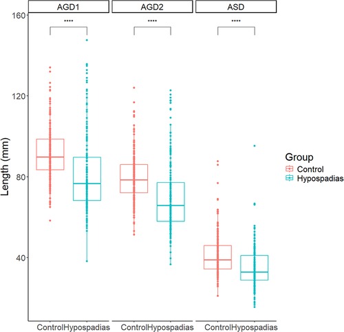 Box plot comparing length measurements in millimeters across three categories: AGD1, AGD2, and ASD. Data is split into two groups, Control and Hypospadias, each represented by different colors. Significant differences, denoted by asterisks, are observed between the groups within each category.