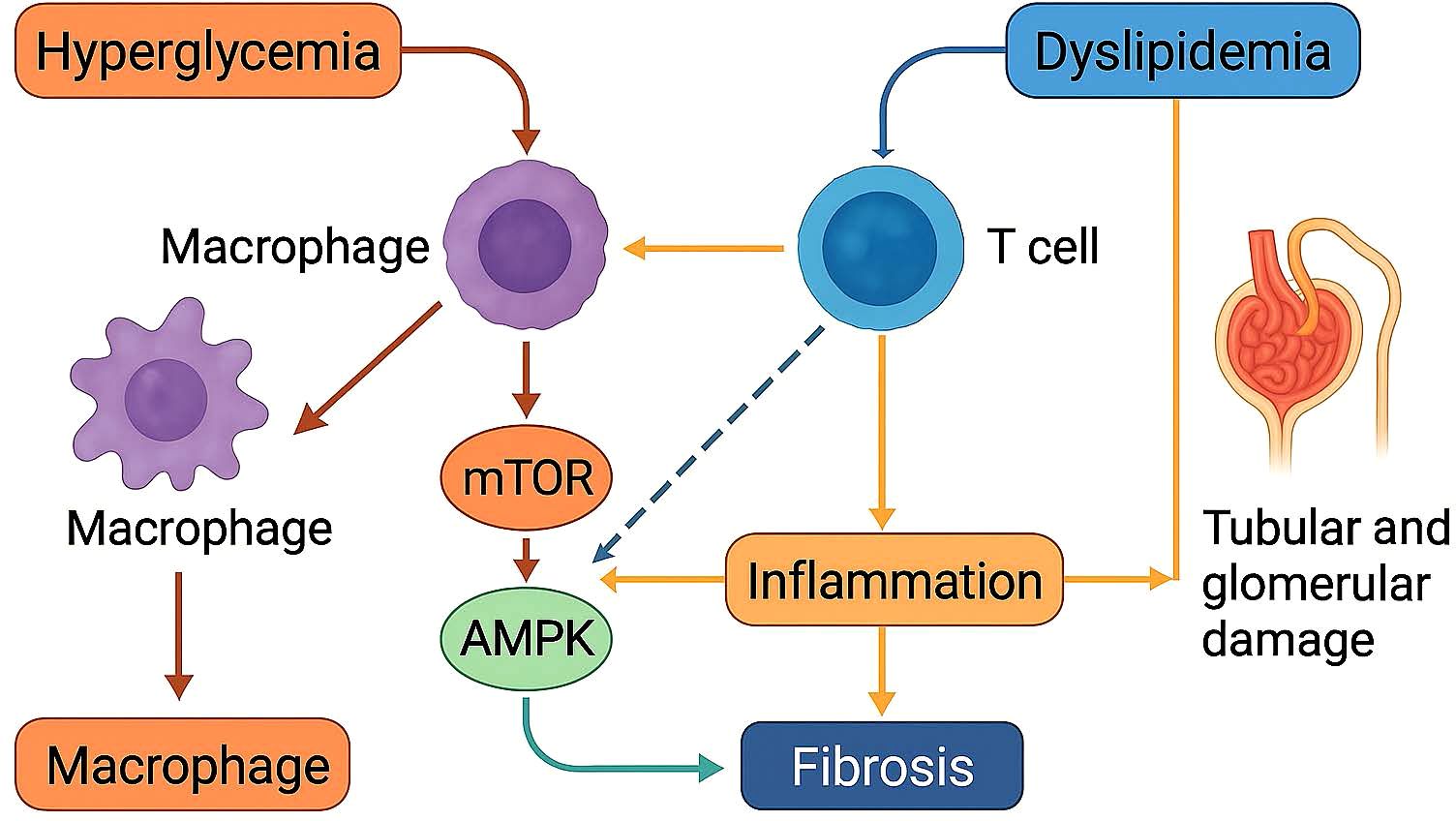 Flowchart illustrating the relationships among hyperglycemia, dyslipidemia, macrophages, T cells, mTOR, AMPK, inflammation, fibrosis, and tubular and glomerular damage. Hyperglycemia and dyslipidemia influence macrophages and T cells, respectively. Macrophages affect mTOR and AMPK, leading to inflammation and fibrosis. Inflammation contributes to kidney damage.