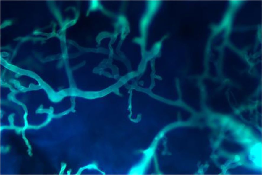 Abstract image with glowing, intertwined, blue and teal lines against a dark blue background, resembling a network of connected branches or filaments.