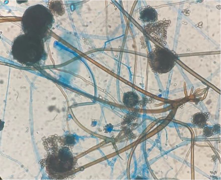 Microscopic view of mold spores and hyphae, featuring tangled strands and clusters. The hyphae appear as thin, branching filaments, while the spores are round and dark, set against a light background.