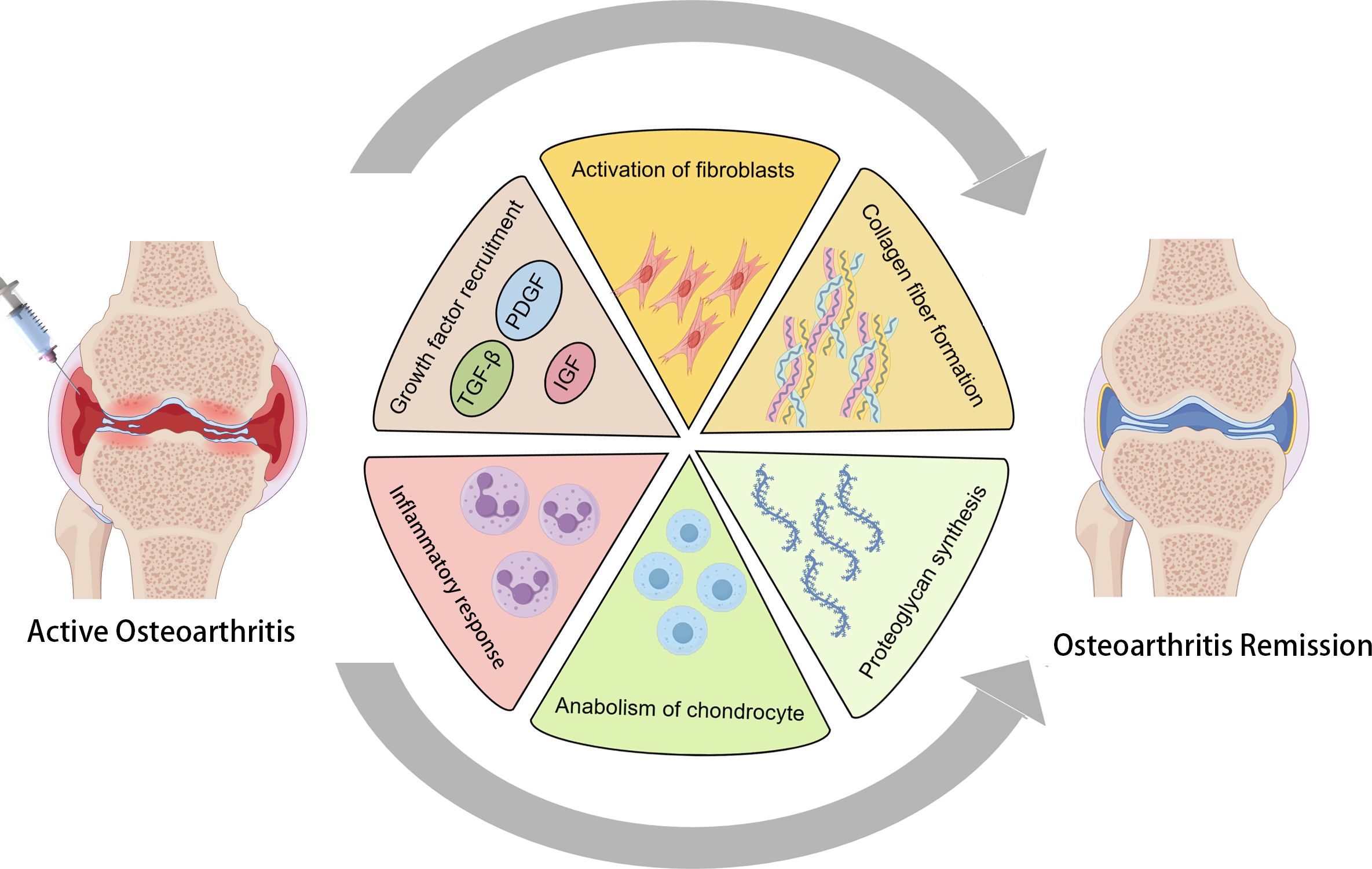 Illustration showing the process of osteoarthritis treatment. On the left, an inflamed joint labeled “Active Osteoarthritis” receives an injection. The central wheel diagram depicts processes including growth factor recruitment, inflammatory response, fibroblast activation, collagen fiber formation, chondrocyte anabolism, and proteoglycan synthesis. On the right, a joint labeled “Osteoarthritis Remission” appears healed. Arrows indicate the transition from active osteoarthritis to remission.