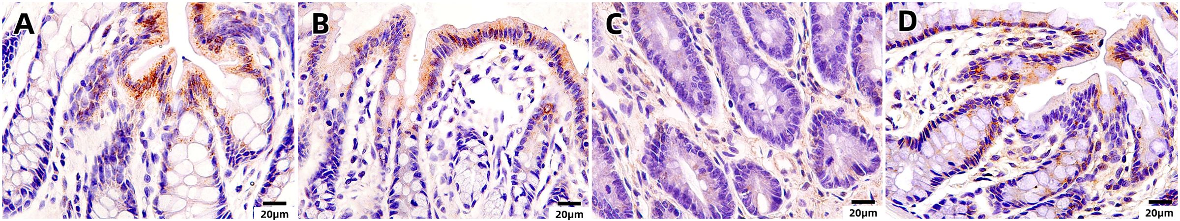 Histological images labeled A, B, C, and D, each showing tissue samples stained to highlight cellular structures. The samples feature varying densities of cells and tissue organization, with a scale bar indicating twenty micrometers for reference.