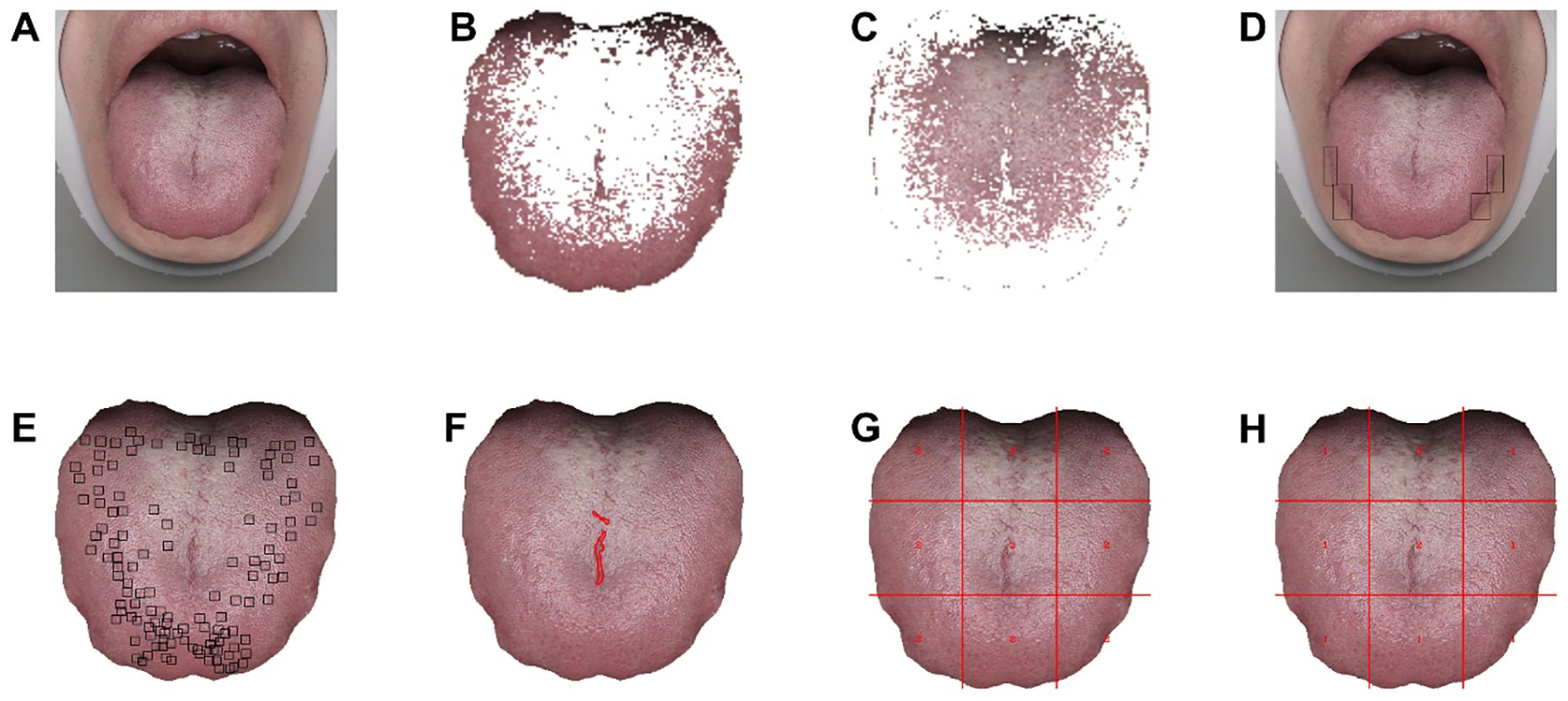 Composite image showing the analysis of a human tongue. Image A and D depict a tongue with open mouth, highlighting different sections. Image B and C show pixelated versions of the tongue. Image E includes small squares, possibly for region analysis. Image F features a red line marking. Image G and H have red grid lines over the tongue, likely indicating sectional data collection areas.