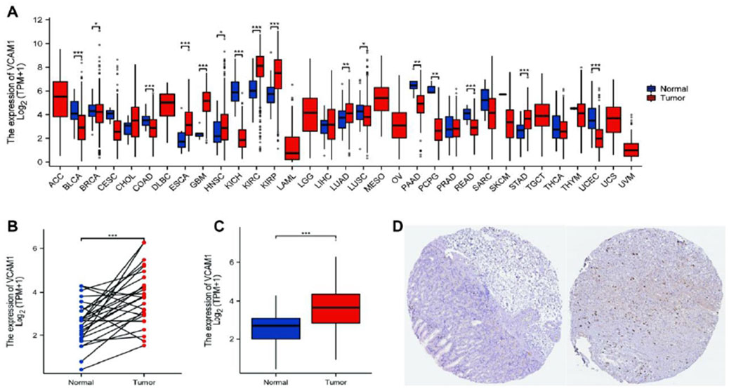 Graphical and histological representations analyze the expression of VCAM1 across various cancer types. A shows box plots comparing VCAM1 expression in normal and tumor tissues for different cancer types. B and C display the expression differences between normal and tumor tissues, with significance indicated by asterisks. D features two histological images contrasting tissue samples, likely to illustrate the physical differences in expression levels.