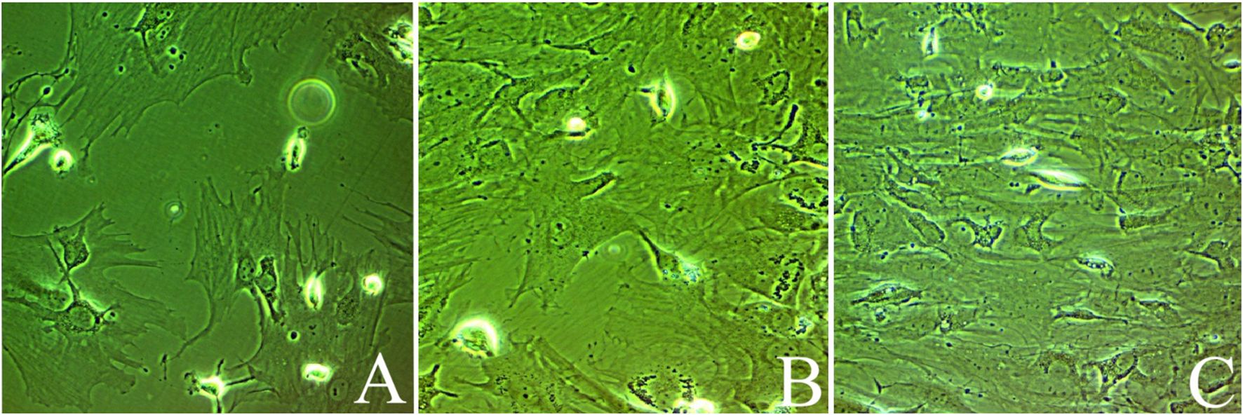 Microscopic images showing three panels labeled A, B, and C, displaying cell cultures under green lighting. Each panel illustrates varying densities and shapes of cells, with A appearing denser than B and C.