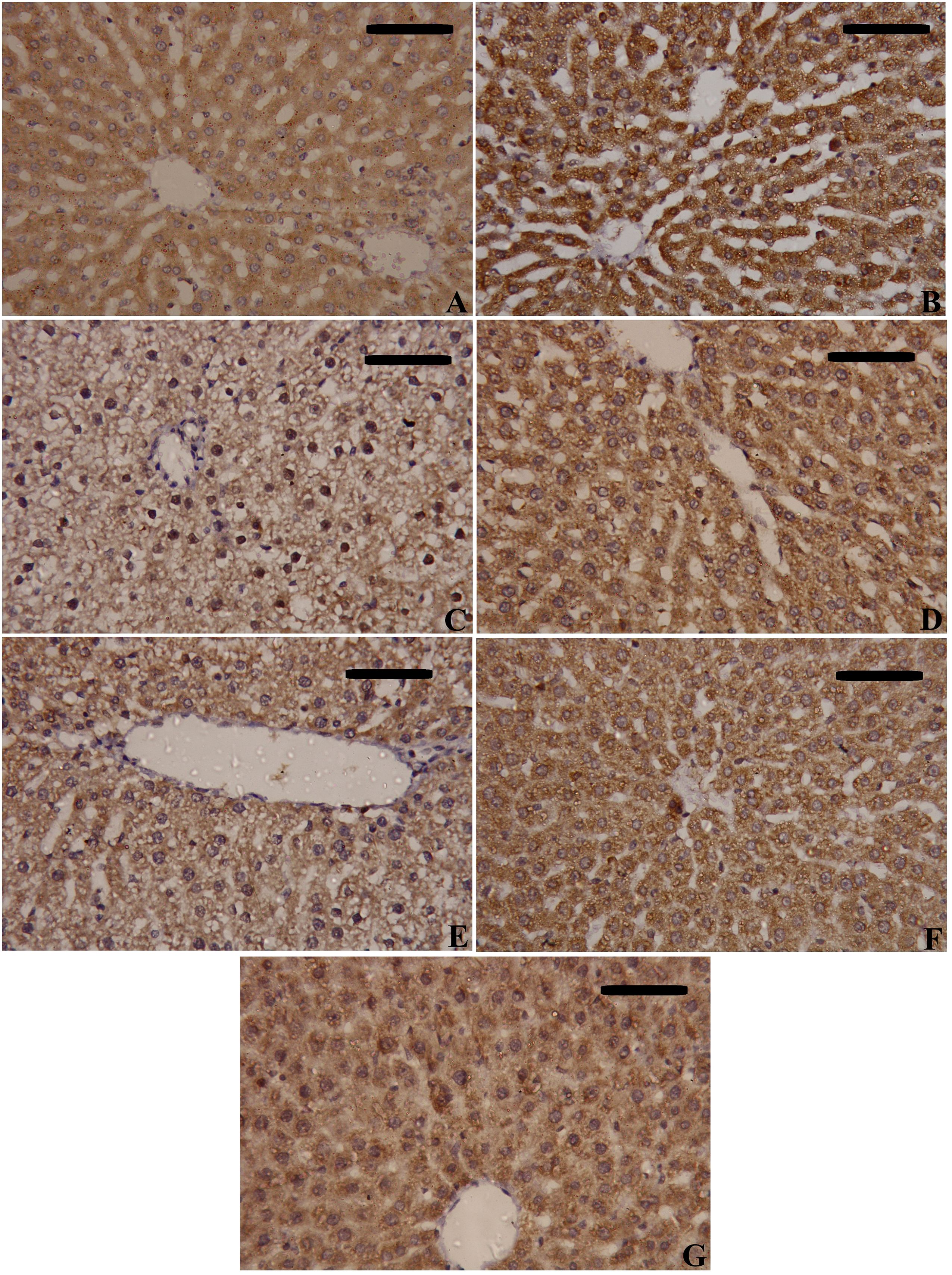 Microscopic images show stained liver tissue sections with labeled panels A to G. The sections highlight varying cell structures, including visible nuclei and distinct patterns indicative of cellular composition. White spaces represent blood vessels or ducts. Staining intensity and cellular arrangement vary across the panels, with some showing clear radiating patterns from central areas. Black bars are present for scale reference.