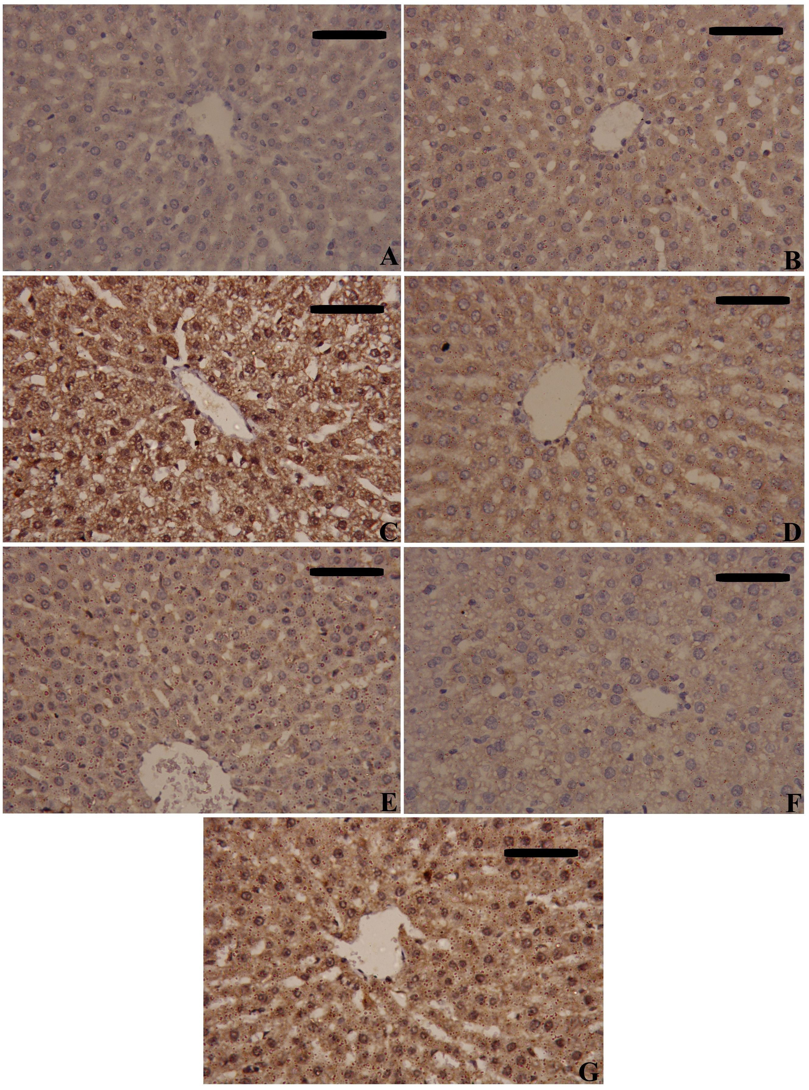 Histological images show varying liver tissue structures under a microscope. Each panel, labeled A to G, displays different staining intensities and cellular patterns. The scale bar is present in each image for reference.