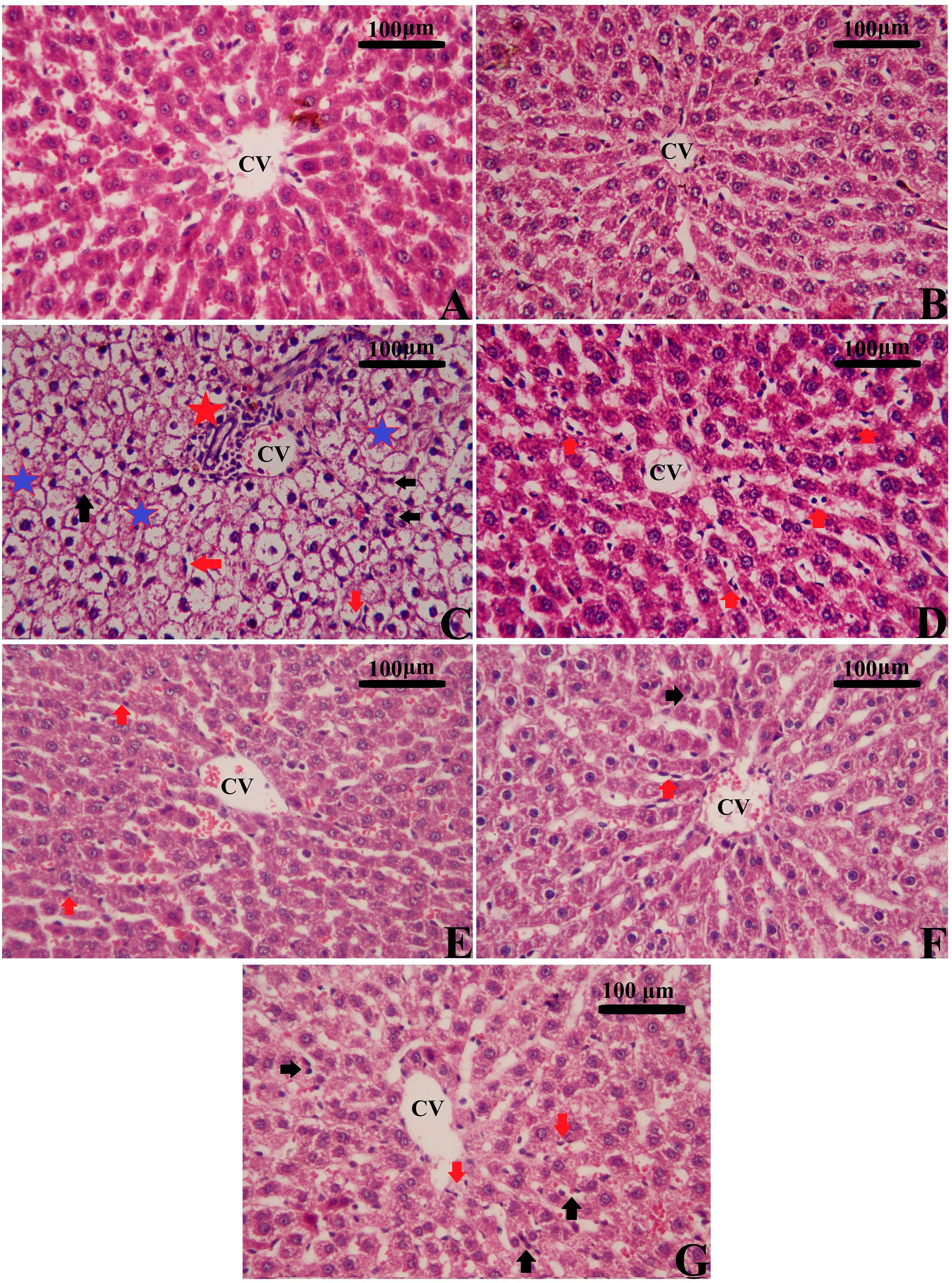 Microscopic images of liver tissue sections labeled A through G, each showing central veins (