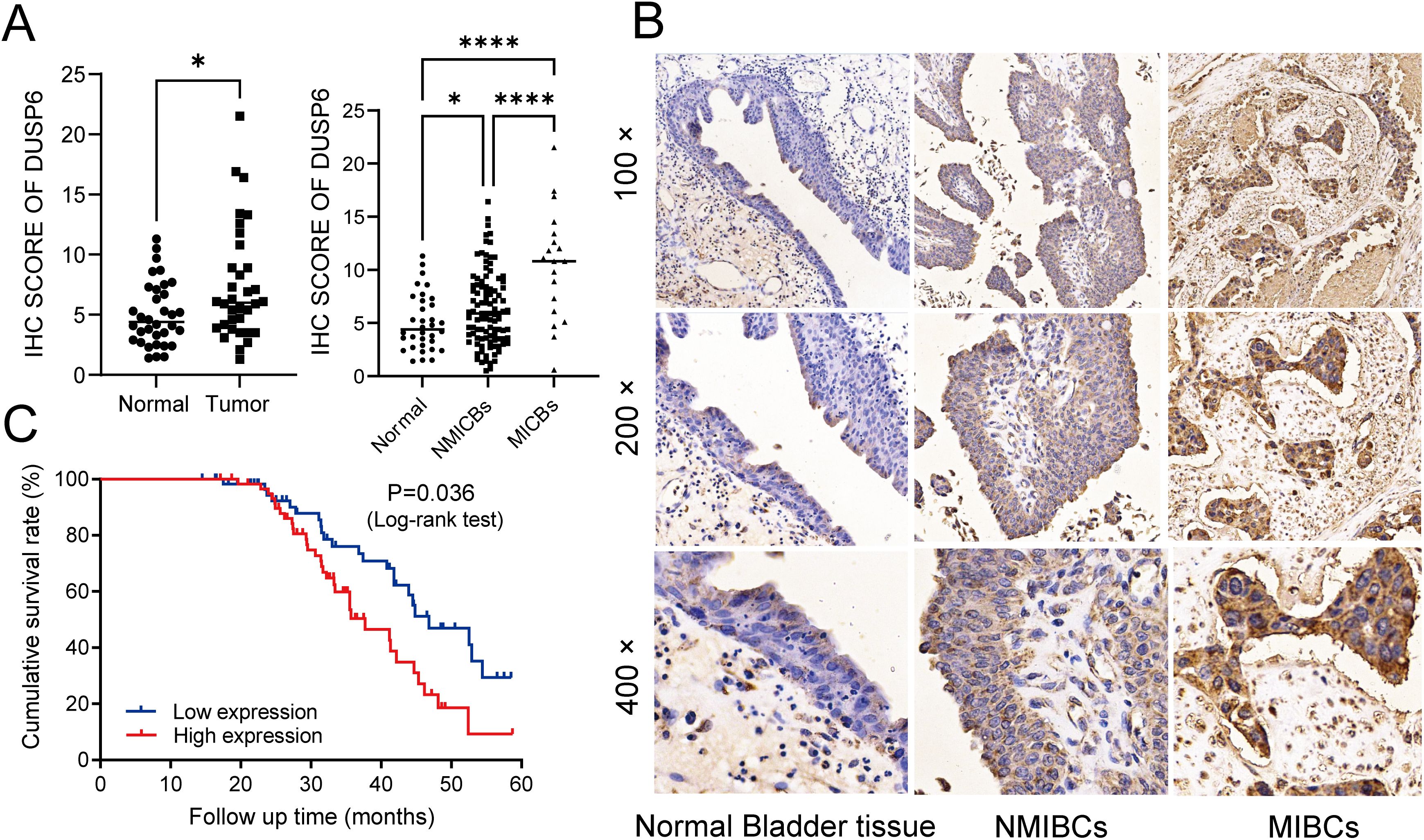 Panel A shows dot plots of IHC scores for DUSP6, comparing normal tissue and tumors, and distinguishing between NMIBCs and MIBCs, with significant differences marked by asterisks. Panel B presents microscopic images of normal bladder tissue, NMIBCs, and MIBCs at magnifications of one hundred times, two hundred times, and four hundred times, highlighting cell structures. Panel C is a Kaplan-Meier survival curve, indicating higher survival rates for low DUSP6 expression over a sixty-month period, with a significant P-value of 0.036.