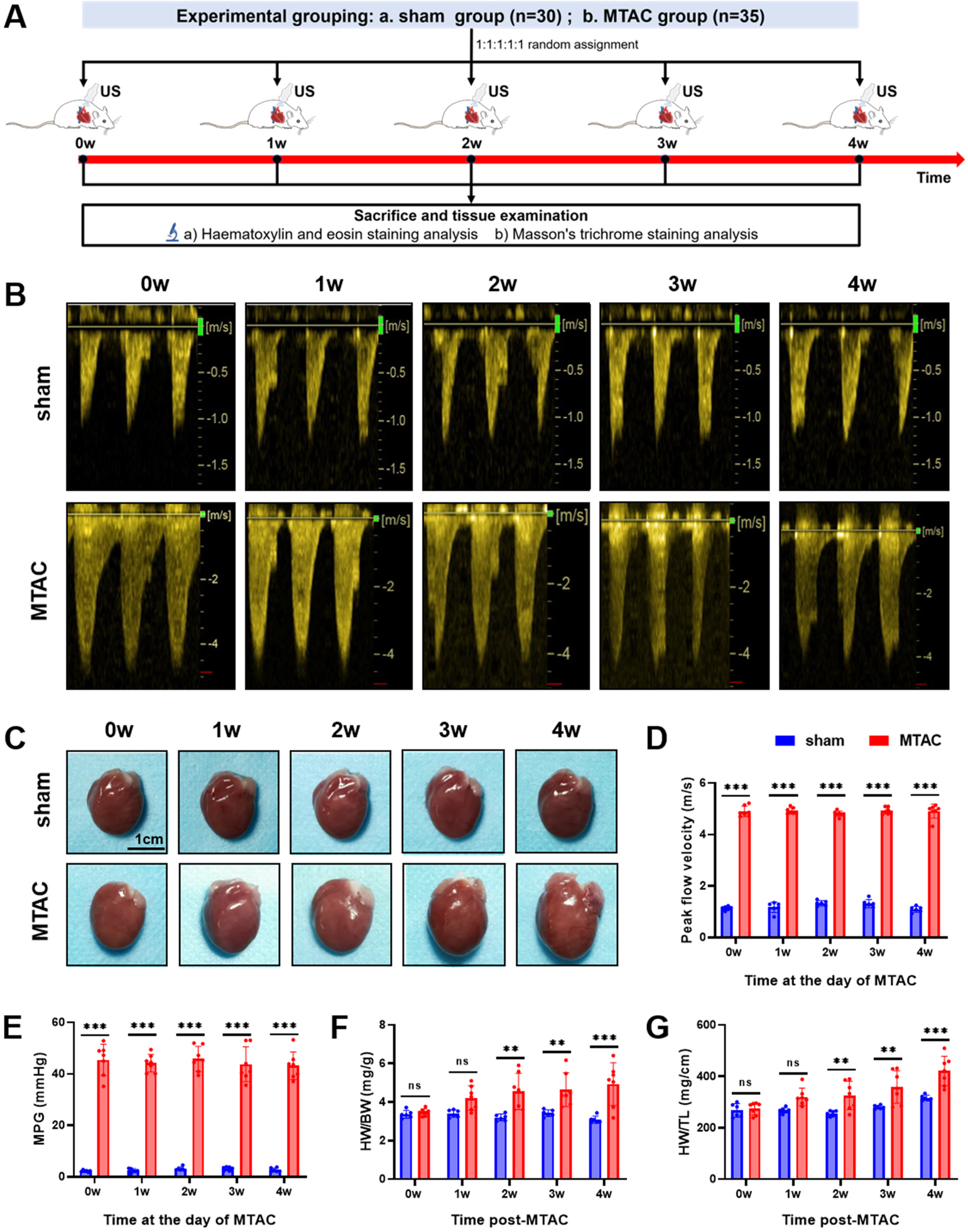 Experimental timeline showing groups and ultrasound (US) events over four weeks. Ultrasound images (B) compare sham and MTAC groups across weeks 0 to 4, displaying peak flow velocity changes. Gross heart images (C) illustrate visible differences in heart morphology between the two groups. Graphs (D-G) depict quantitative analysis, comparing metrics like peak flow velocity, mean pressure gradient, heart weight to body weight ratio, and heart weight to tibial length ratio across time points, with significant differences highlighted between sham and MTAC groups.