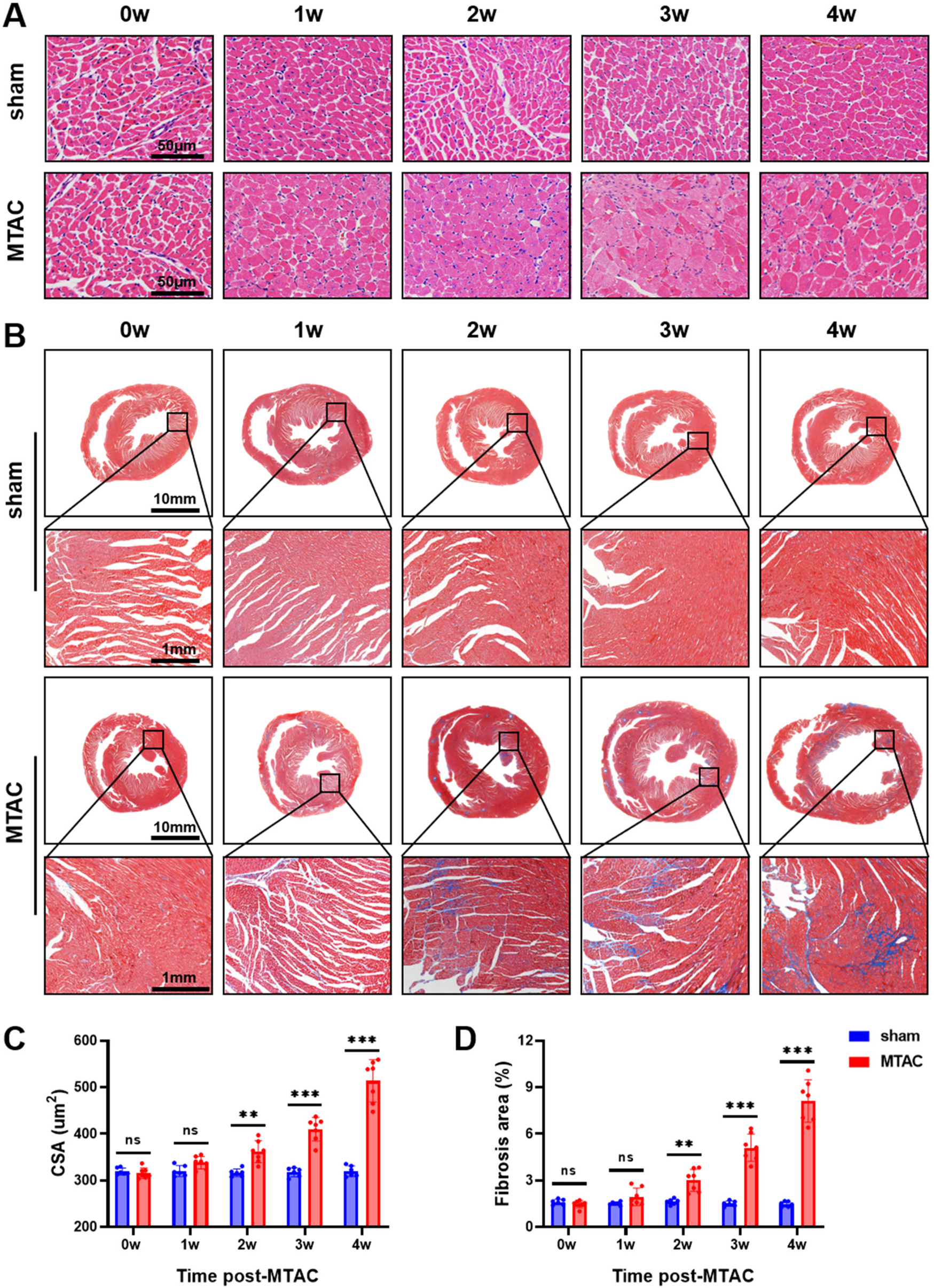 Histological analysis and charts depicting the effects of MTAC treatment over time. Panel A shows muscle tissue samples stained and compared at intervals (0w to 4w) between sham and MTAC groups. Panel B illustrates heart tissue cross-sections with magnified views over the same intervals. Graph C presents measurements of cross-sectional area (CSA) comparing sham and MTAC groups, highlighting increases in the MTAC group. Graph D illustrates fibrosis area percentages, with MTAC showing significant increases post-treatment compared to sham.