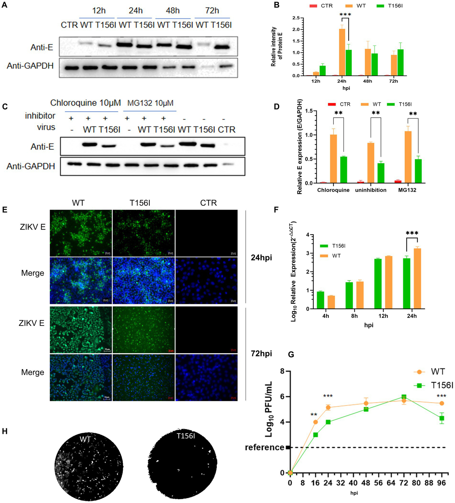 This image contains multiple panels showing experimental data related to virus studies.A: Western blots showing protein expression at different time points (12h, 24h, 48h, 72h) for CTR, WT, and T156I using anti-E and anti-GAPDH antibodies.B: Bar graph of relative intensity ratios for CTR, WT, and T156I, showing significant differences.C: Western blots demonstrating protein expression under different treatment conditions with Chloroquine and MG132.D: Bar graph of relative E expression normalized to GAPDH for different treatments, showing significant differences.E: Immunofluorescence images comparing ZIKV E protein expression in WT, T156I, and CTR at 24hpi and 72hpi.F: Line graph of log-transformed relative expression for T156I and WT over time, showing significant differences.G: Line graph of log-transformed plaque-forming units per milliliter for WT and T156I over different time points, highlighting significant differences.H: Images comparing plaque formation for WT and T156I.