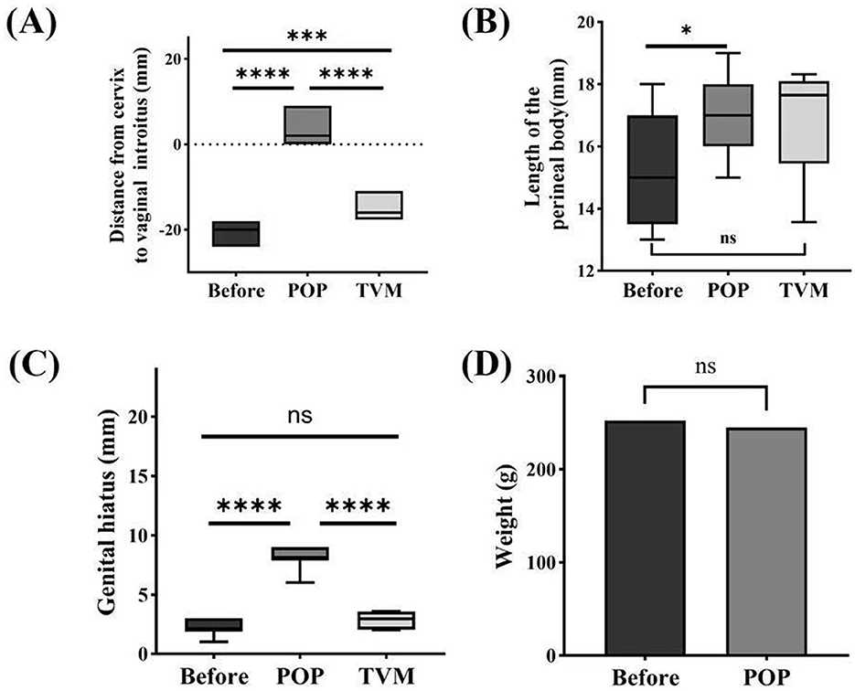 Two panels labeled A and B depict graphs comparing nominal strain over time and bar charts of ultimate load. Both graphs show three lines: control (purple), OVX (red), and POP (green). The control group displays the highest nominal strain and ultimate load, followed by OVX and then POP. Bar charts indicate significant differences between control, OVX, and POP, with marked asterisks showing statistical significance.