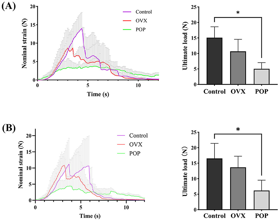 (A) Box plot showing the distance from cervix to vaginal introitus in millimeters before, during POP, and after TVM, with significant differences indicated by asterisks. (B) Box plot displaying the length of the perineal body, with significant differences noted between before and POP but not POP and TVM. (C) Box plot illustrating genital hiatus size, with significant changes before, POP, and TVM. (D) Bar graph comparing the weight in grams before and after POP, showing no significant difference.