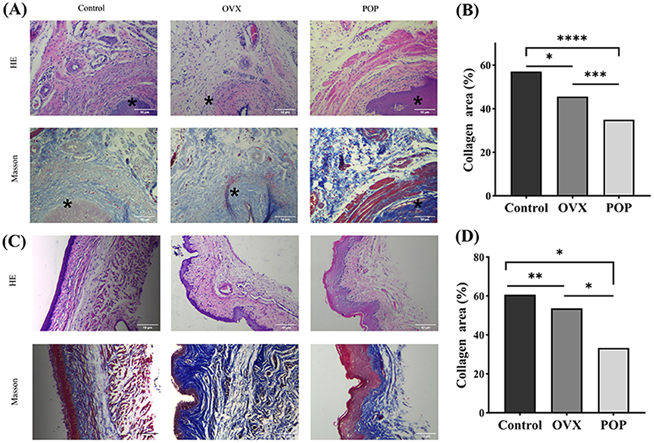 (A) Microscopic images showing tissue samples in Control, OVX, and POP groups stained with HE and Masson methods, indicating differences in structure. (B) Bar graph displaying collagen area percentages for Control, OVX, and POP groups, with significant differences marked by asterisks. (C) Additional tissue images from the same groups, also stained with HE and Masson. (D) Another bar graph showing collagen area percentages with significant differences indicated by asterisks.