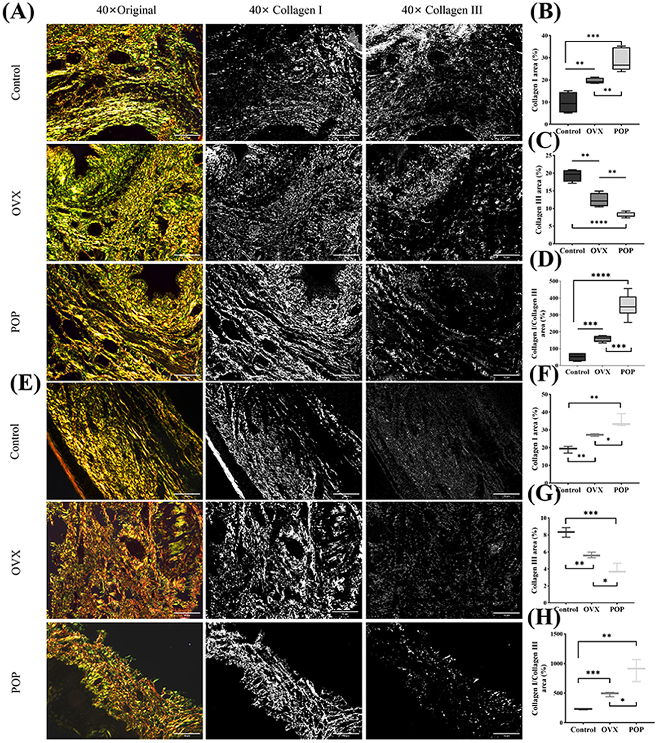Histological images and box plots depicting collagen levels. (A, E) Show original and stained tissue sections at forty times magnification for control, OVX, and POP groups. (B–D, F–H) Are box plots comparing collagen I and III areas among the three groups. Statistical significance is indicated by asterisks.