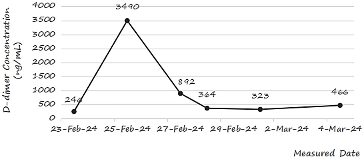 Line graph showing D-dimer concentration in nanograms per milliliter from February 23 to March 4, 2024. Concentrations rise from 246 ng/mL on February 23 to a peak of 3490 ng/mL on February 25, then decline to 466 ng/mL by March 4.