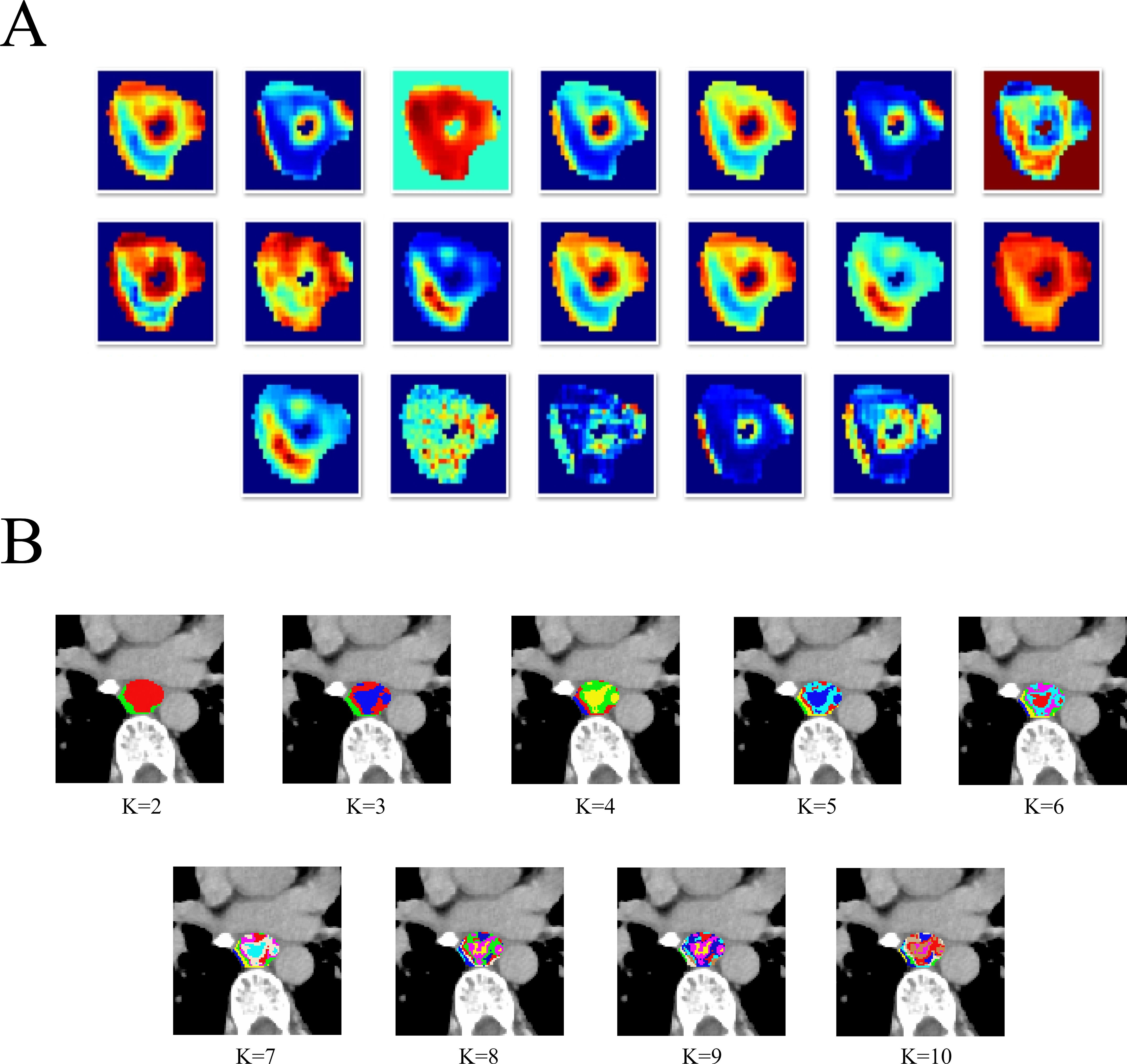 Panel A shows multiple heatmaps with varying color intensities, possibly representing different data points or conditions. Panel B displays a series of gray-scale medical images with highlighted regions in color, labeled from K=2 to K=10, suggesting different segmentation analyses or categories.