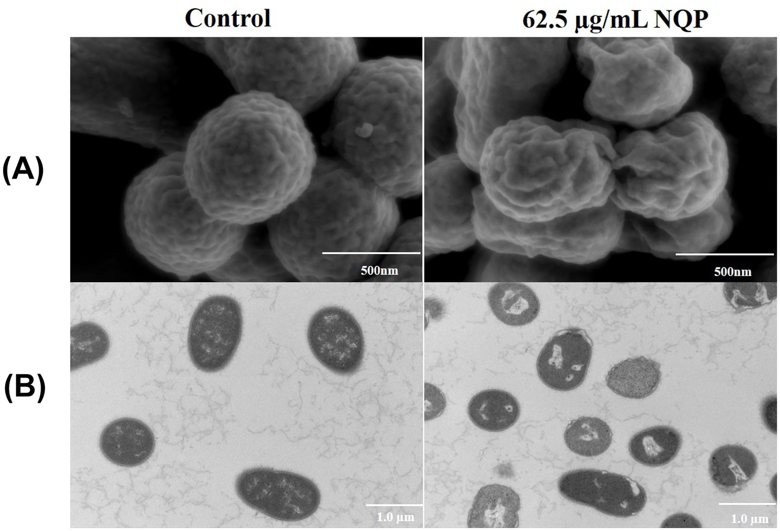 Electron microscope images showing bacterial cells with two conditions: On the left, cells under control conditions appear spherical and smooth. On the right, cells treated with 62.5 micrograms per milliliter NQP show clustered and irregular shapes. The top images have a scale of 500 nanometers, while the bottom images scale to 1.0 micrometer.