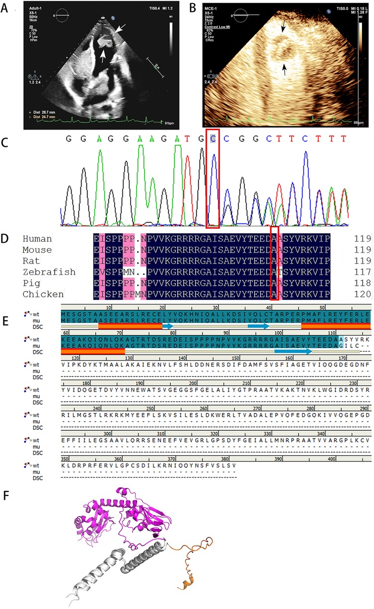 A: Ultrasound image showing a heart with arrows indicating a specific area. B: Ultrasound image with enhanced contrast, arrows pointing to a region. C: DNA sequencing graph with labeled nucleotides. D: Protein sequence alignment across various species: human, mouse, rat, zebrafish, pig, and chicken, highlighting amino acid similarities. E: Protein sequence alignment with differences in wild type and mutated versions marked. F: 3D protein structure illustration with sections highlighted in different colors.