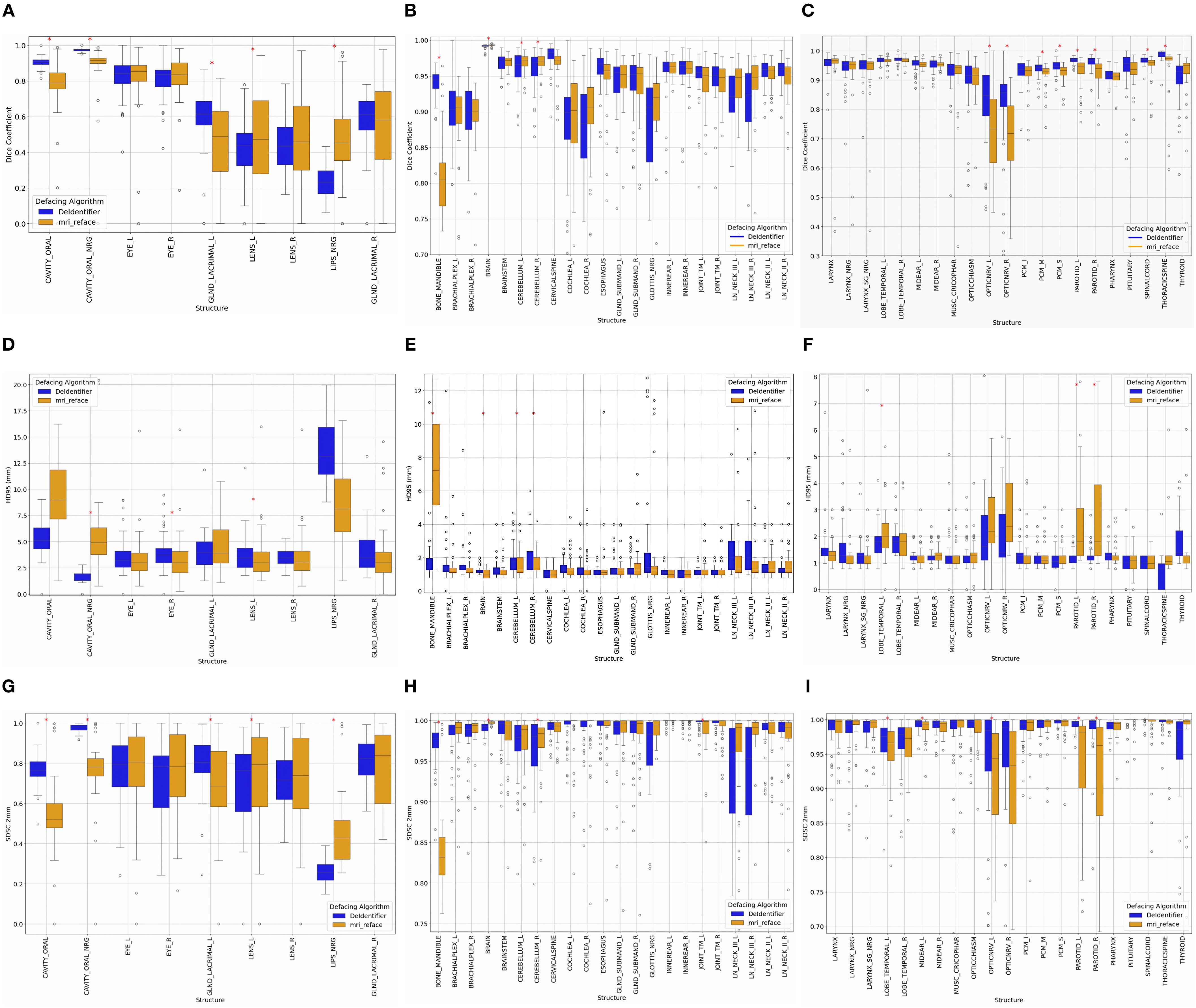 Nine box plots labeled A through I compare two defacing algorithms, DeIdentifier and mri_reface, across various anatomical structures and performance metrics. Each plot includes a legend and data points (shown as dots), illustrating variation within each structure. The plots capture differences in performance, reflecting algorithm effectiveness.