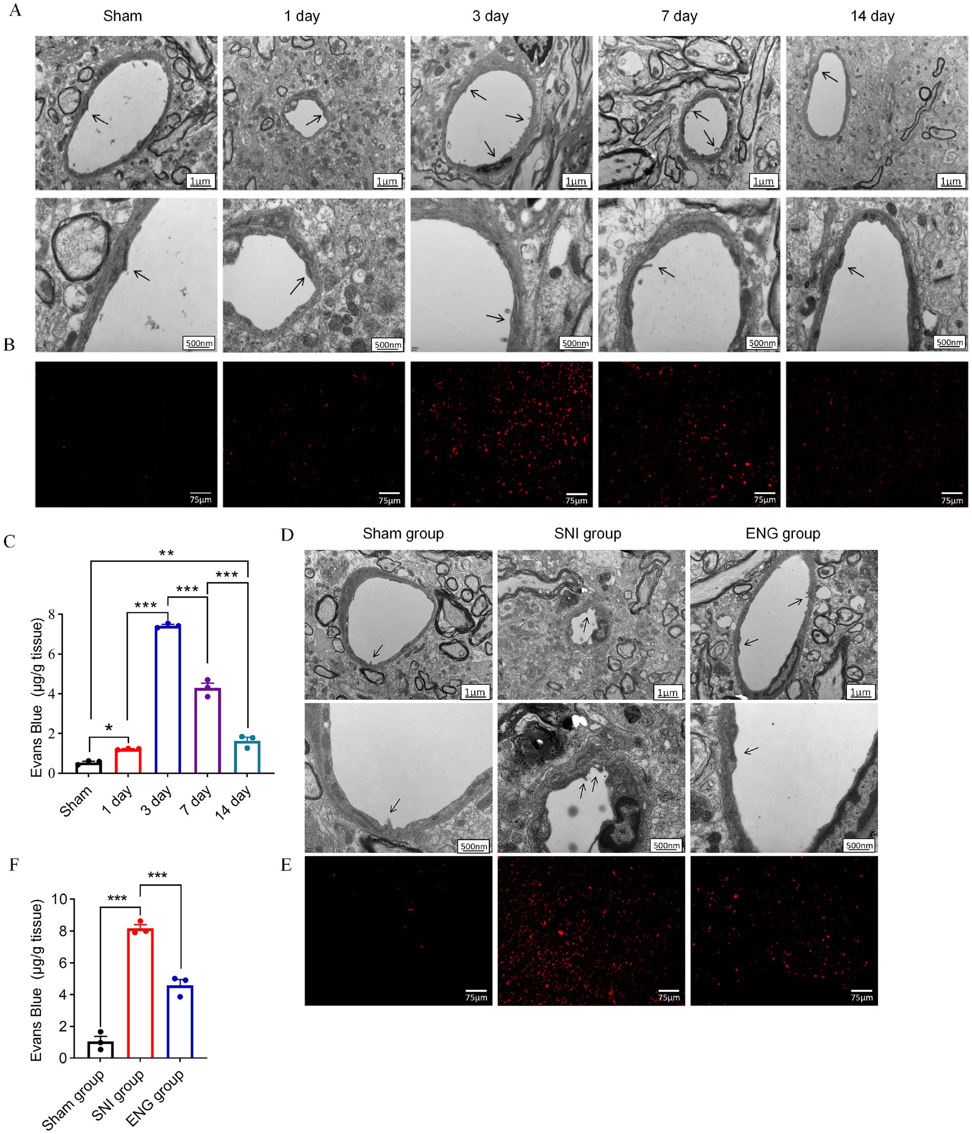 A series of scientific images depicting nerve injury analysis over different time points. Panel A shows electron micrographs of nerve tissues labeled as Sham, 1 day, 3 day, 7 day, and 14 day, with arrows indicating specific features. Panel B presents fluorescent images showing Evans Blue dye uptake. Panel C is a bar graph displaying quantitative data of Evans Blue levels in tissue over time, with significance marked by asterisks. Panel D features electron micrographs for Sham, SNI, and ENG groups, with arrows highlighting details. Panel E shows corresponding fluorescent images. Panel F is a bar graph comparing Evans Blue levels across groups, also marked with significance indicators.