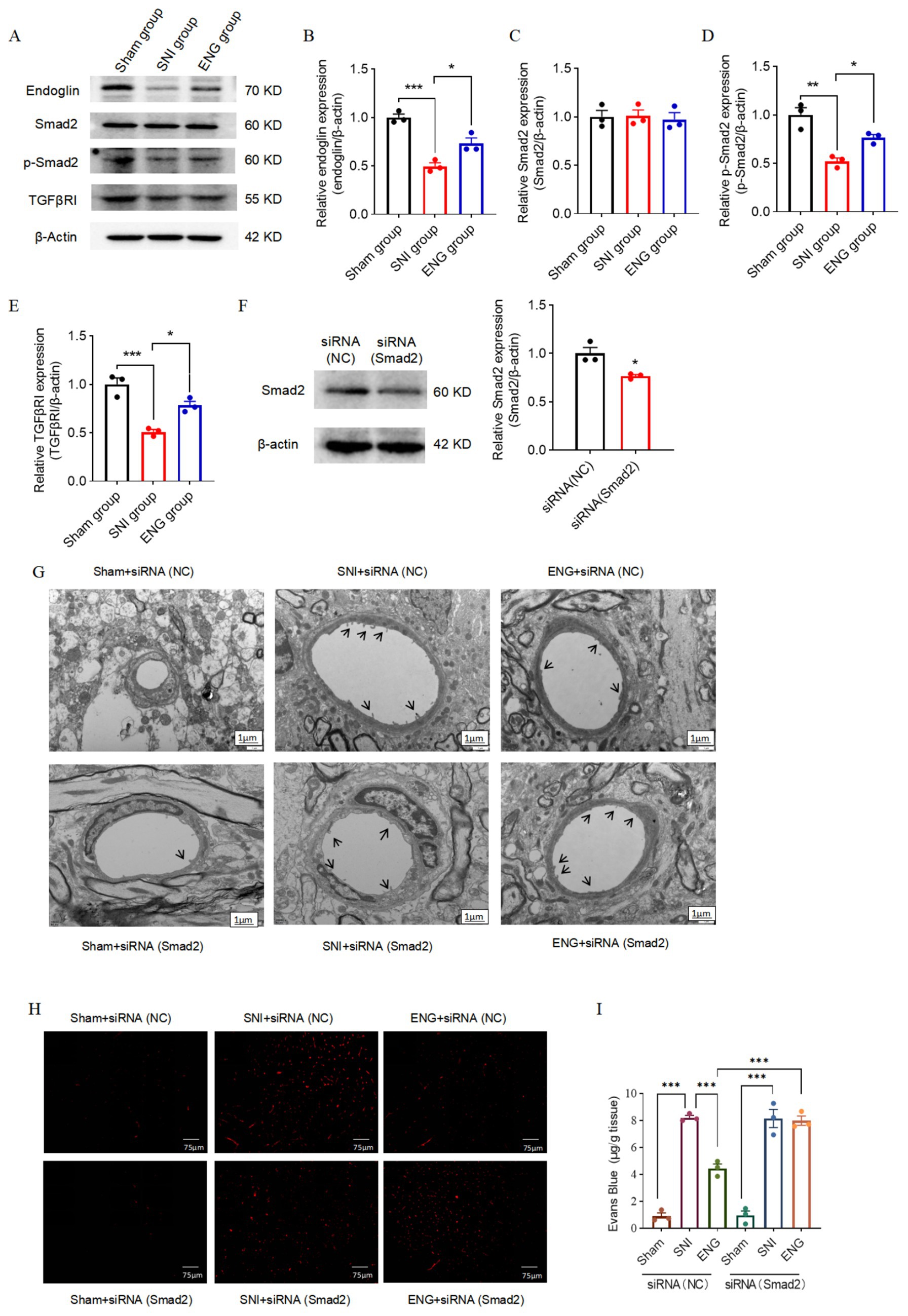 Western blot and bar graph results show expression levels of Endoglin, Smad2, p-Smad2, and TGFβR1 across Sham, SNI, and ENG groups, with significant differences indicated. Smad2 expression is also shown between siRNA (NC) and siRNA (Smad2) treatments. Electron microscopy images display cellular structures with siRNA effects, and fluorescent images reveal microstructures under different treatments. A bar graph illustrates Evans Blue accumulation, with significant variation across conditions. Statistical significance is indicated with asterisks.