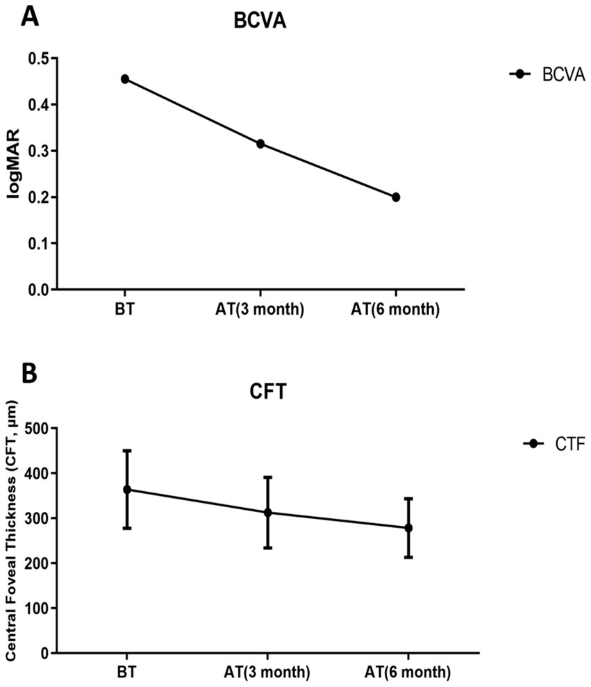 Line graphs displaying changes over time. Graph A shows a decline in Best Corrected Visual Acuity (BCVA) in logMAR over three time points: before treatment, three months, and six months after treatment. Graph B illustrates a decrease in Central Foveal Thickness (CFT) from before treatment to six months after, with standard deviation bars.