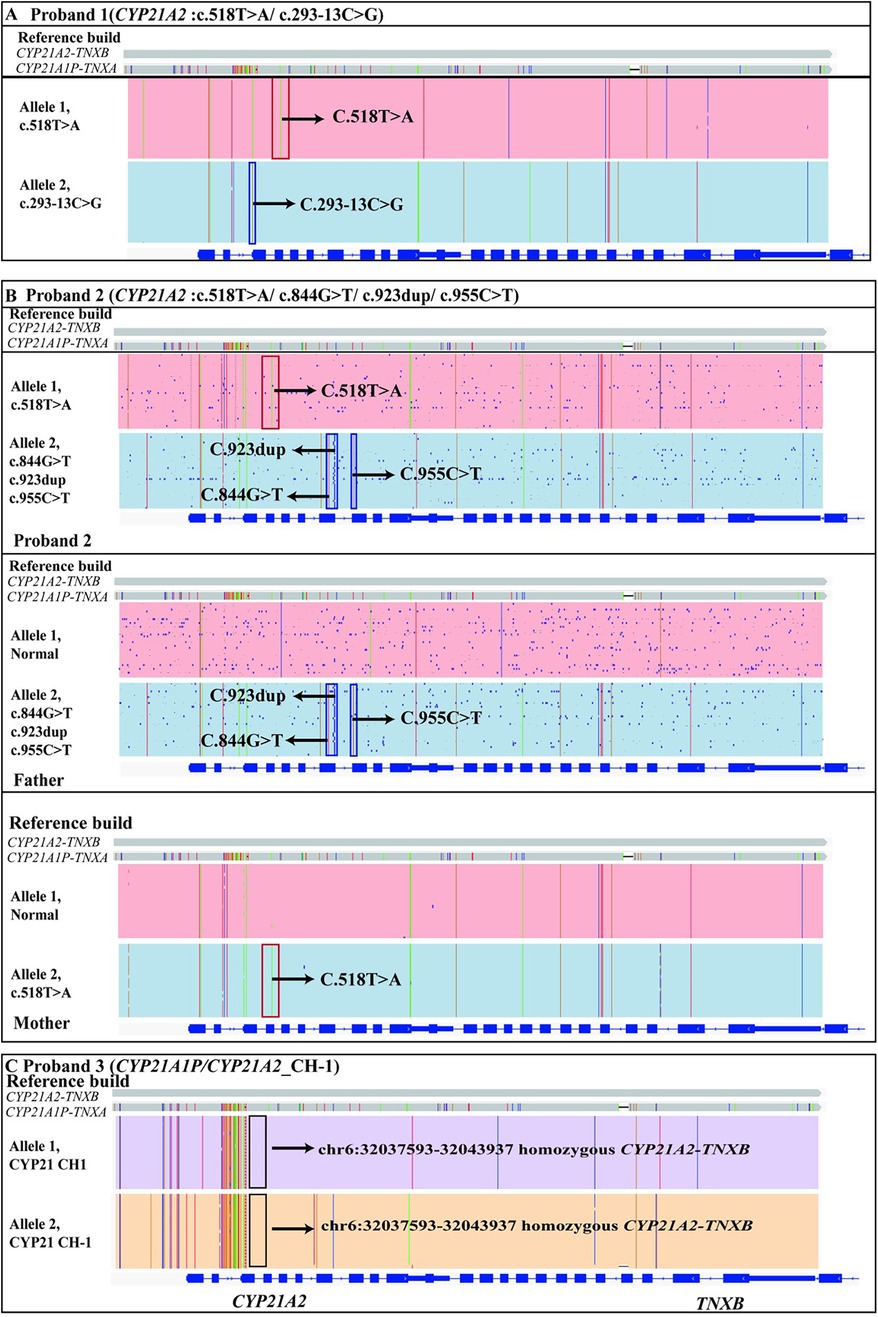 Genetic analysis panels showing variations in CYP21A2 and related genes for three probands and family members. Panels A and B illustrate nucleotide changes and duplications, highlighting variants in alleles. Panel C displays homozygous regions on chromosome 6. Color coding differentiates the genetic alterations. Arrows indicate specific mutations.
