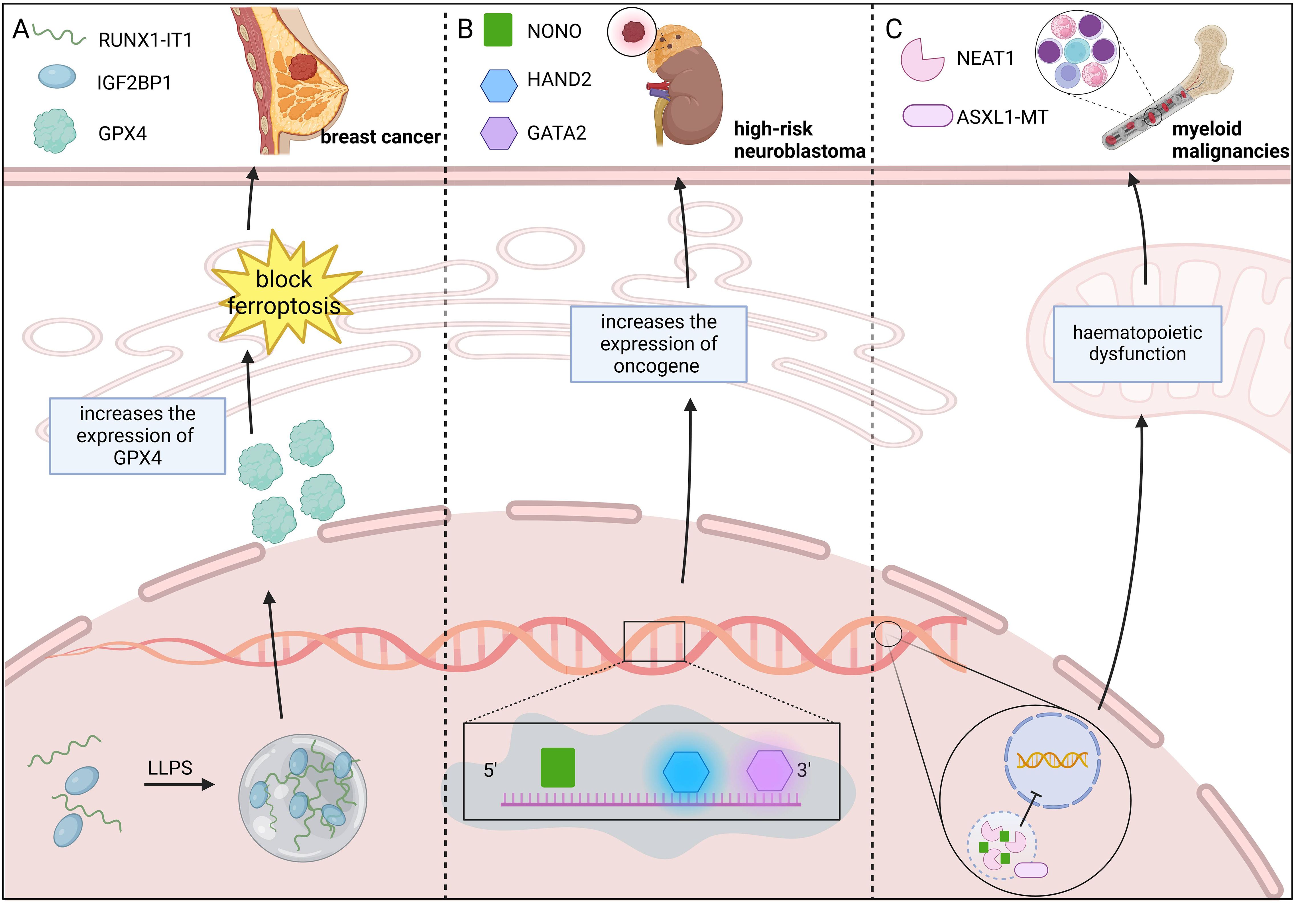 Illustration depicting the role of various proteins and genes in cancer types. Panel A: RUNX1-IT1, IGF2BP1, and GPX4 involved in breast cancer by blocking ferroptosis. Panel B: NONO, HAND2, and GATA2 increase oncogene expression in high-risk neuroblastoma. Panel C: NEAT1 and ASXL1-MT linked to hematopoietic dysfunction in myeloid malignancies. Each section shows cellular processes and interactions.