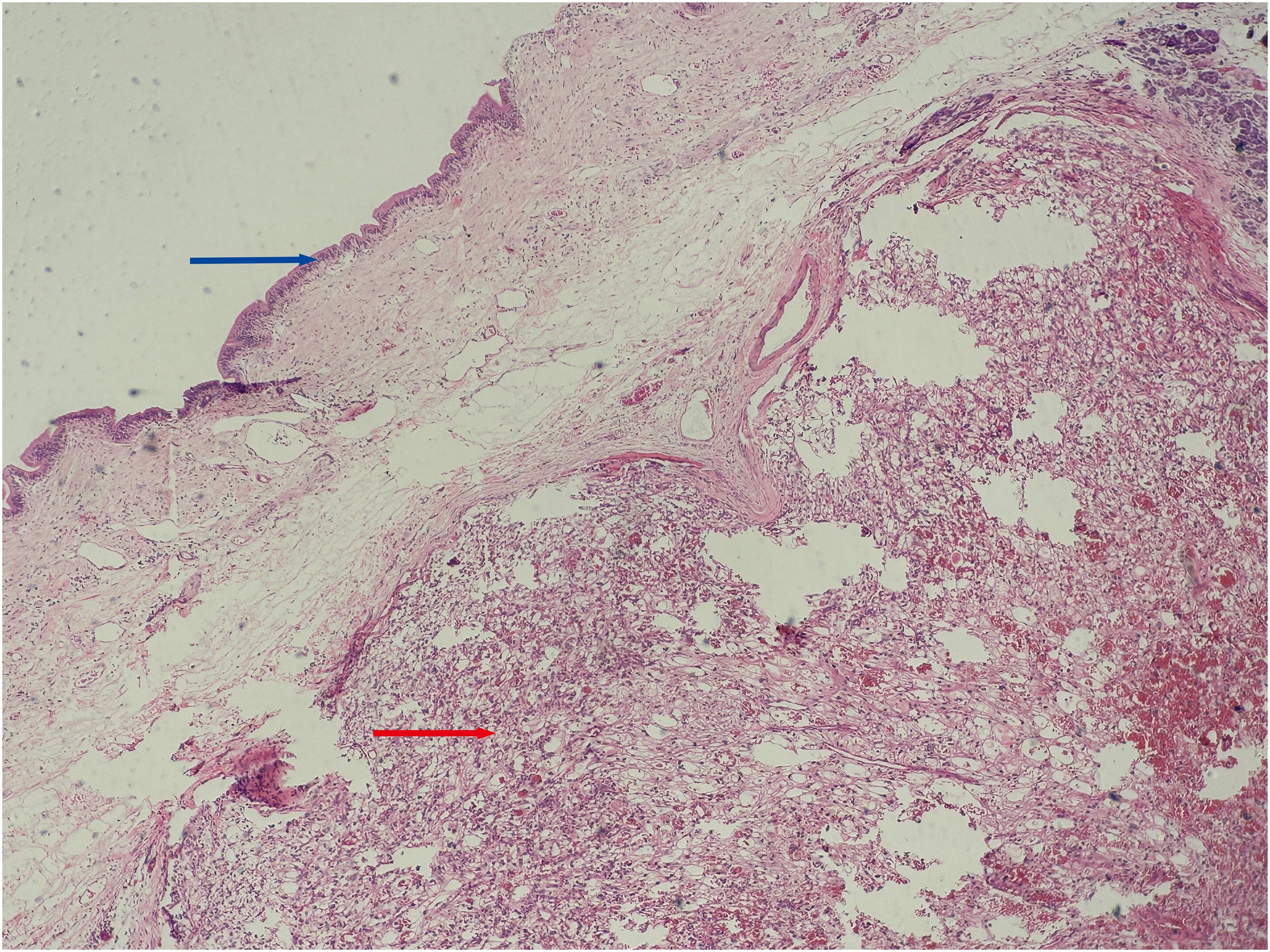 Histological image of a cross-section of human skin tissue. The keratin layer is indicated by a blue arrow, and a red arrow points to a region of adipose tissue. The sample shows varying textures and shades of pink and white, reflecting different tissue densities and types.