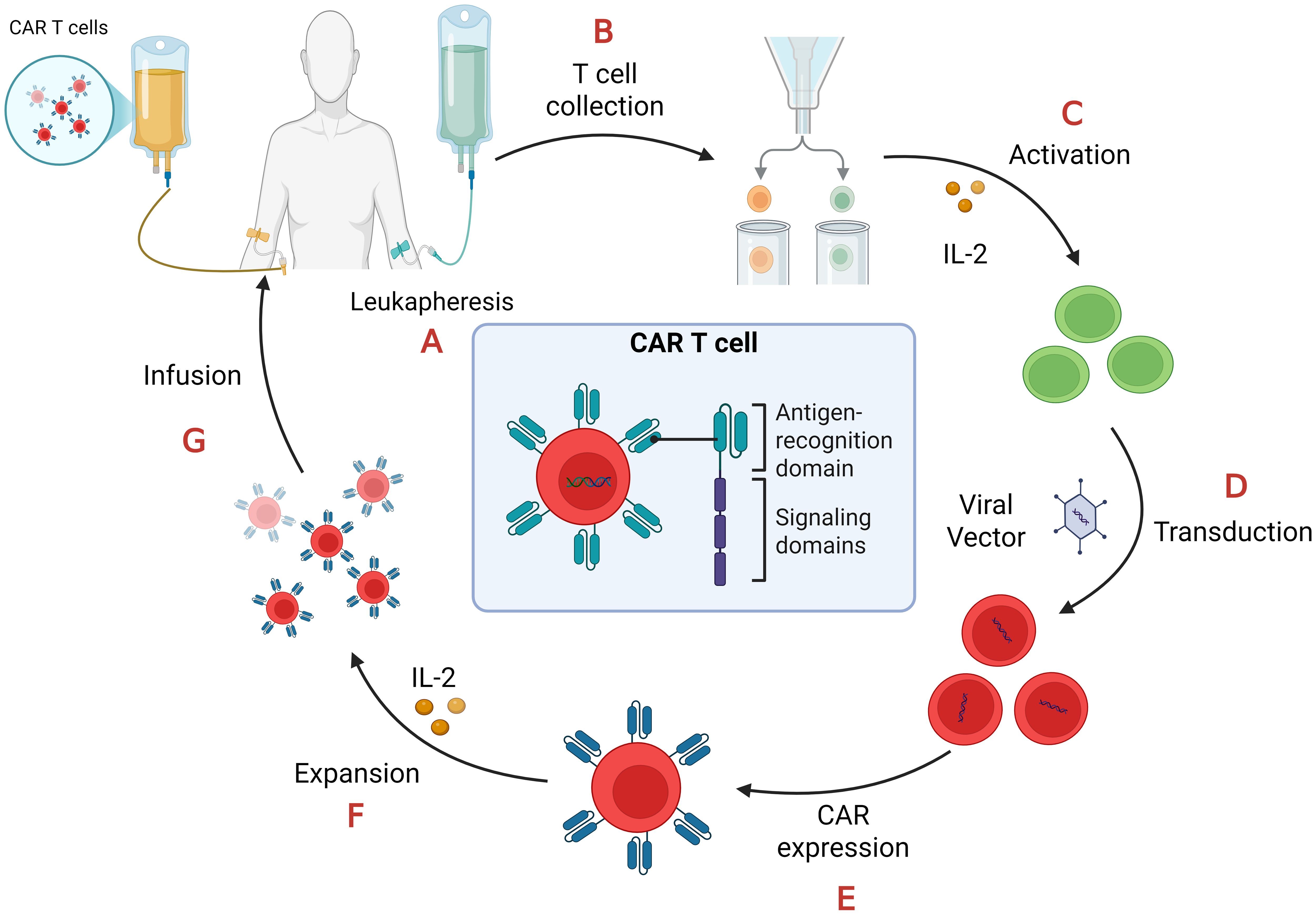 Schematic of the CAR T-cell therapy process. It starts with leukapheresis to collect T cells (step 1), followed by T cell collection (step 2), activation with IL-2 (step 3), viral vector transduction (step 4), CAR expression (step 5), expansion with IL-2 (step 6), and finally, infusion back into the patient (step 7). A CAR T cell is depicted with antigen-recognition and signaling domains.