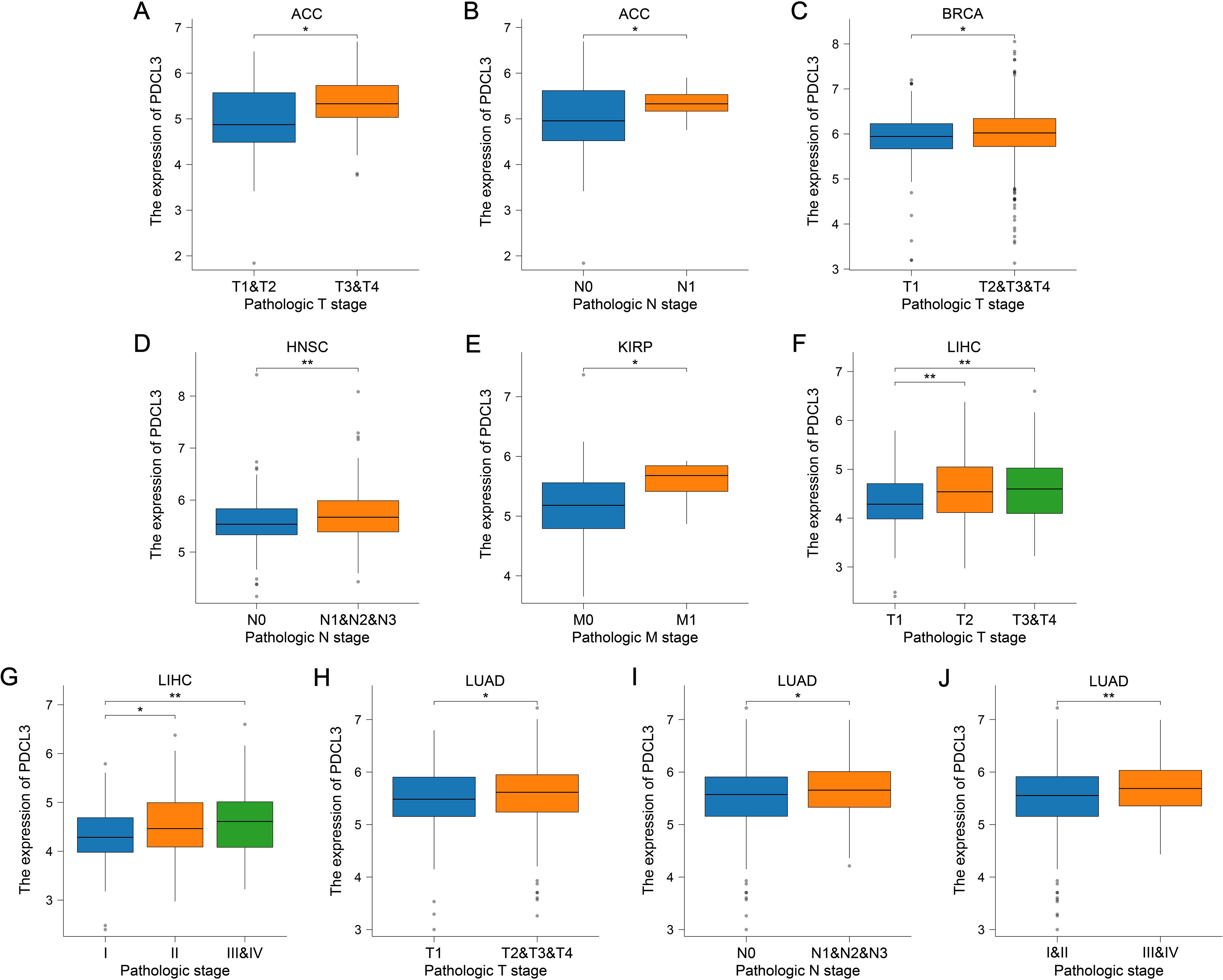 Box plots illustrating the expression levels of PDCL3 across different pathological stages for various cancers. Panels A and B show ACC with significant differences in T and N stages. Panel C shows BRCA with notable differences in T stages. Panels D and E depict HNSC and KIRP, showing differences in N and M stages, respectively. Panel F and G relate to LIHC, highlighting differences in T and overall pathological stages. Panels H, I, and J illustrate LUAD across different T, N, and pathological stages, respectively, with significant differences marked by asterisks.