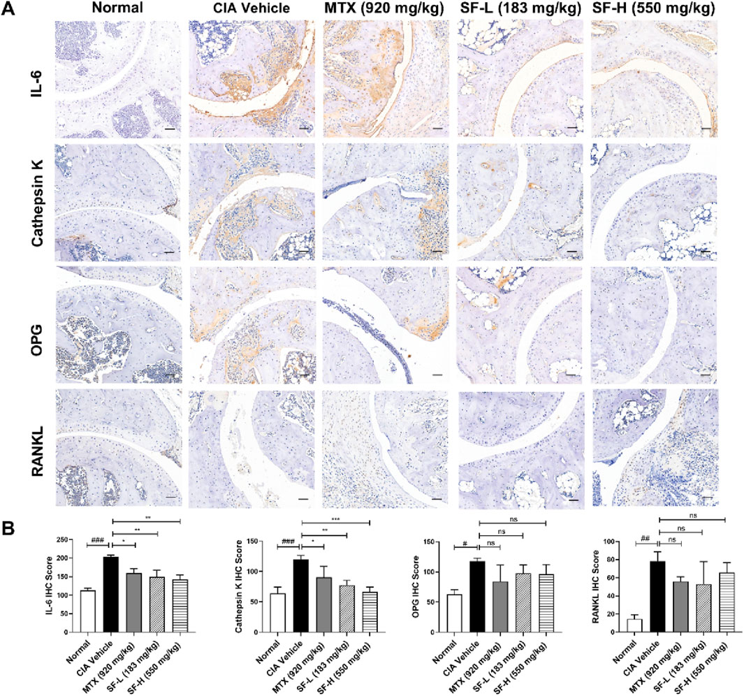 Two panels show immunohistochemistry results and bar graphs. Panel A includes stained tissue sections for IL-6, Cathepsin K, OPG, and RANKL across five treatments: Normal, CIA Vehicle, MTX, SF-L, and SF-H. Panel B presents bar graphs comparing immunohistochemistry scores for each marker under the same treatments, with statistical significance indicated by asterisks and hashtags.