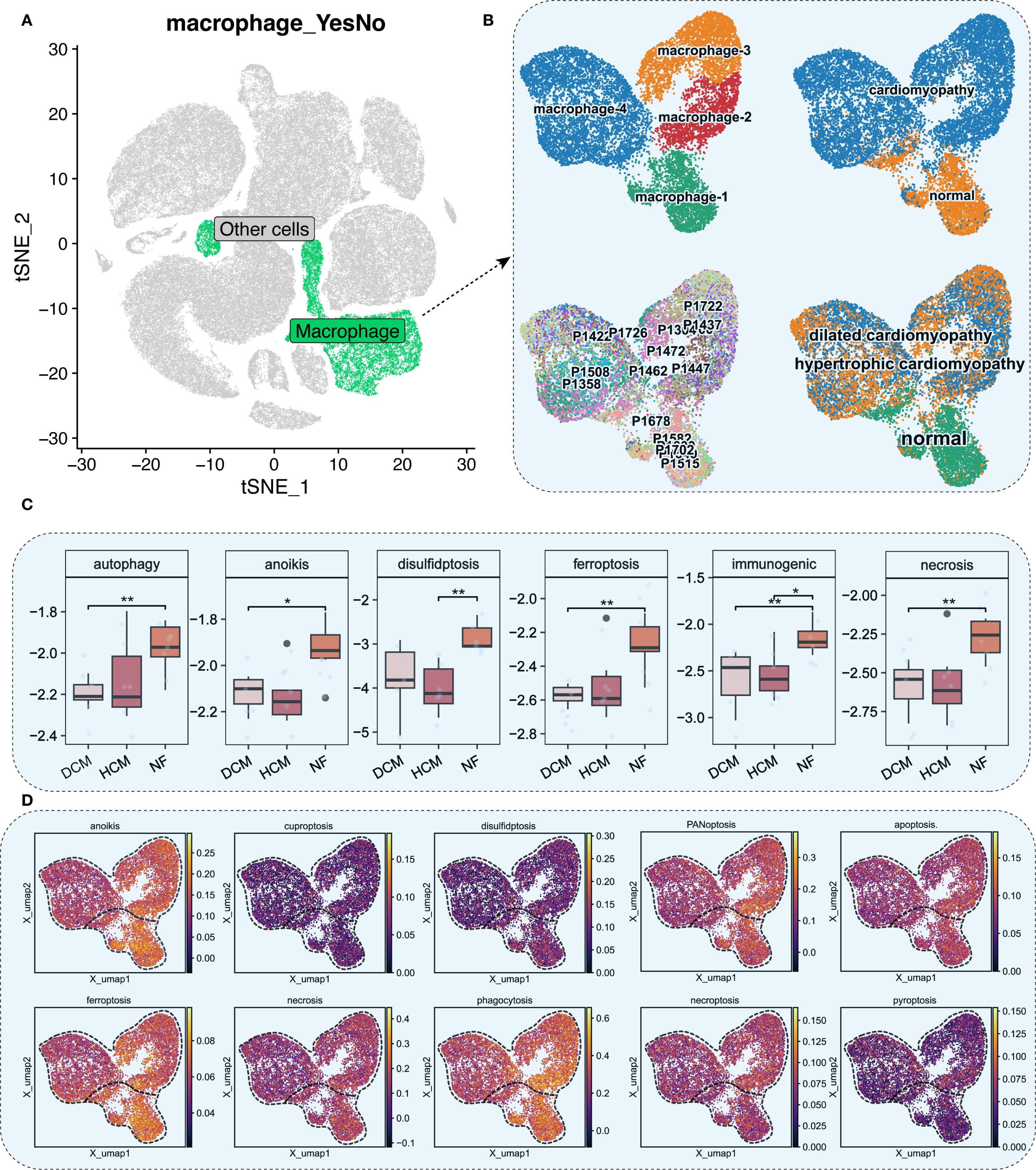 Clustered t-SNE and UMAP plots analyze macrophage data. Panel A distinguishes macrophages from other cells. Panel B shows detailed macrophage subtypes and disease conditions like cardiomyopathy. Panel C features box plots for cellular processes across conditions: DCM (dilated cardiomyopathy), HCM (hypertrophic cardiomyopathy), and NF (healthy human myocardium). Panel D displays UMAP plots for various cell death processes, including anoikis, disulfidptosis, and necrosis. Key differences in cell behavior and condition-specific processes are visualized.