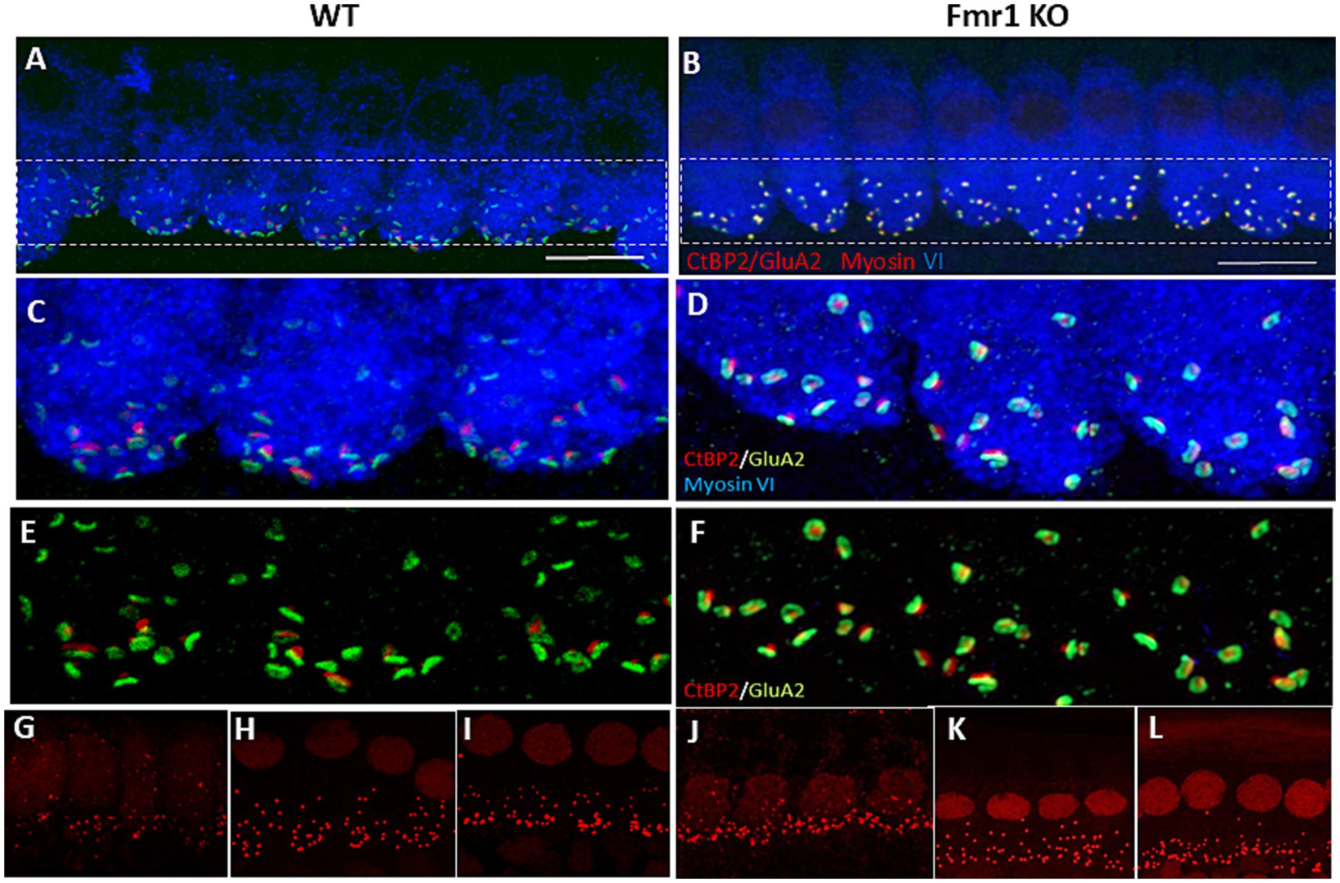 Fluorescence microscopy images comparing wild type (WT) and Fmr1 knockout (KO) samples. Panels A to F show blue-stained cell structures with red and green puncta, indicating CtBP2/GluA2 and Myosin VI proteins. Images G to L highlight red fluorescence, emphasizing CtBP2/GluA2 in both genotypes.
