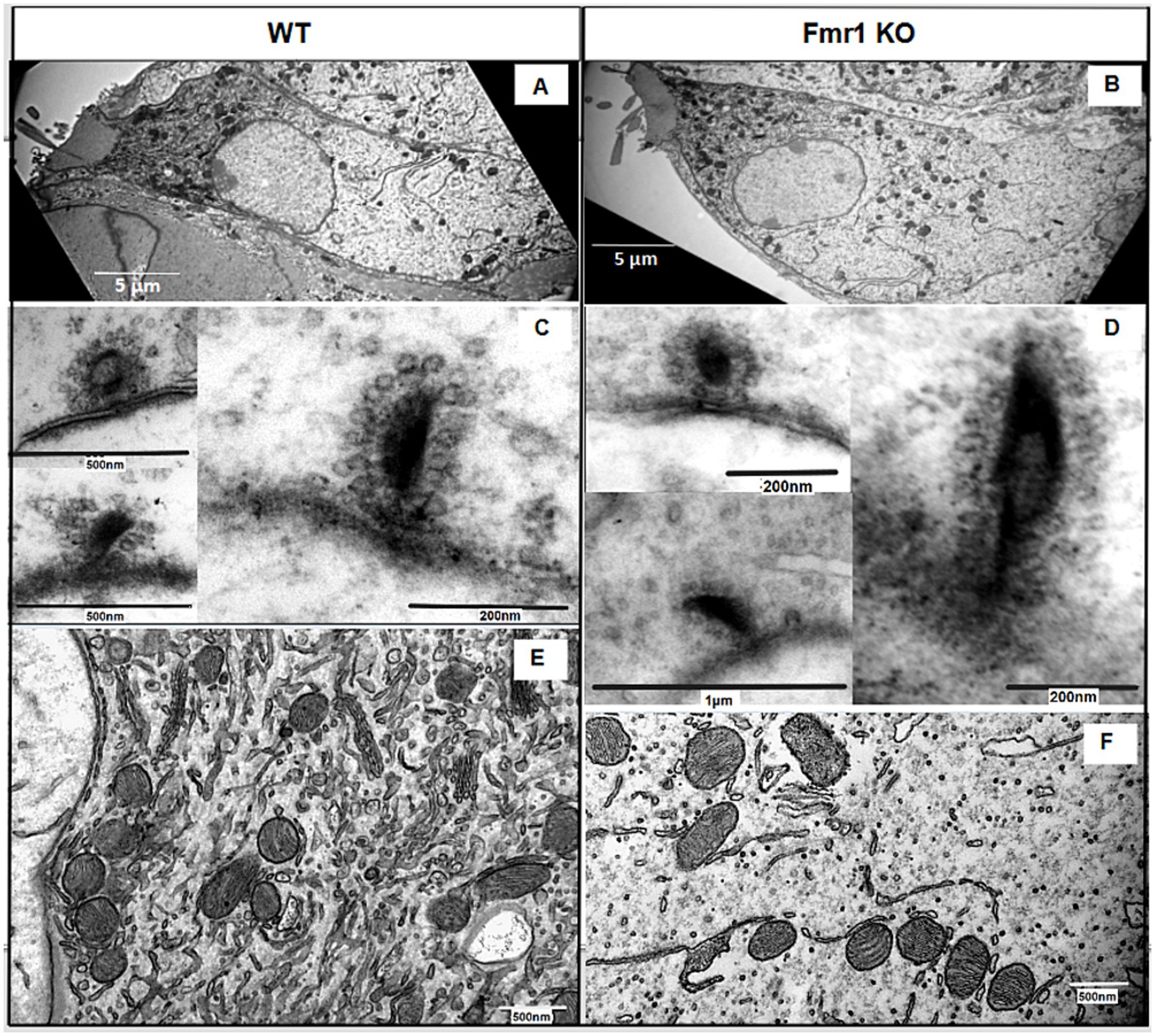 Electron micrographs show comparisons between wild-type (WT) and Fmr1 knockout (KO) cells. Panels A and B display overall cell structure at 5 micrometers. Panels C and D highlight detailed cell features at 200 nanometers. Panels E and F depict different cellular regions at 500 nanometers.
