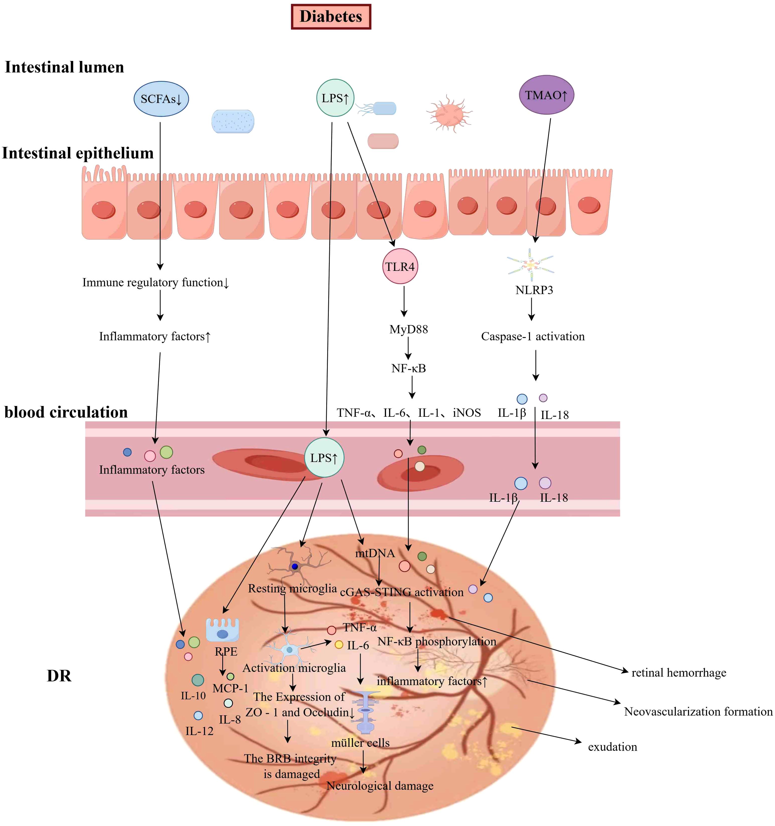 Diagram illustrating the impact of diabetes on the intestinal lumen, blood circulation, and diabetic retinopathy (DR). It shows how increased LPS and TMAO levels affect immune function, activating TLR4 and NLRP3, which elevates inflammatory factors, leading to microglial activation and neurological damage in DR. This results in retinal hemorrhage, neovascularization, and exudation.