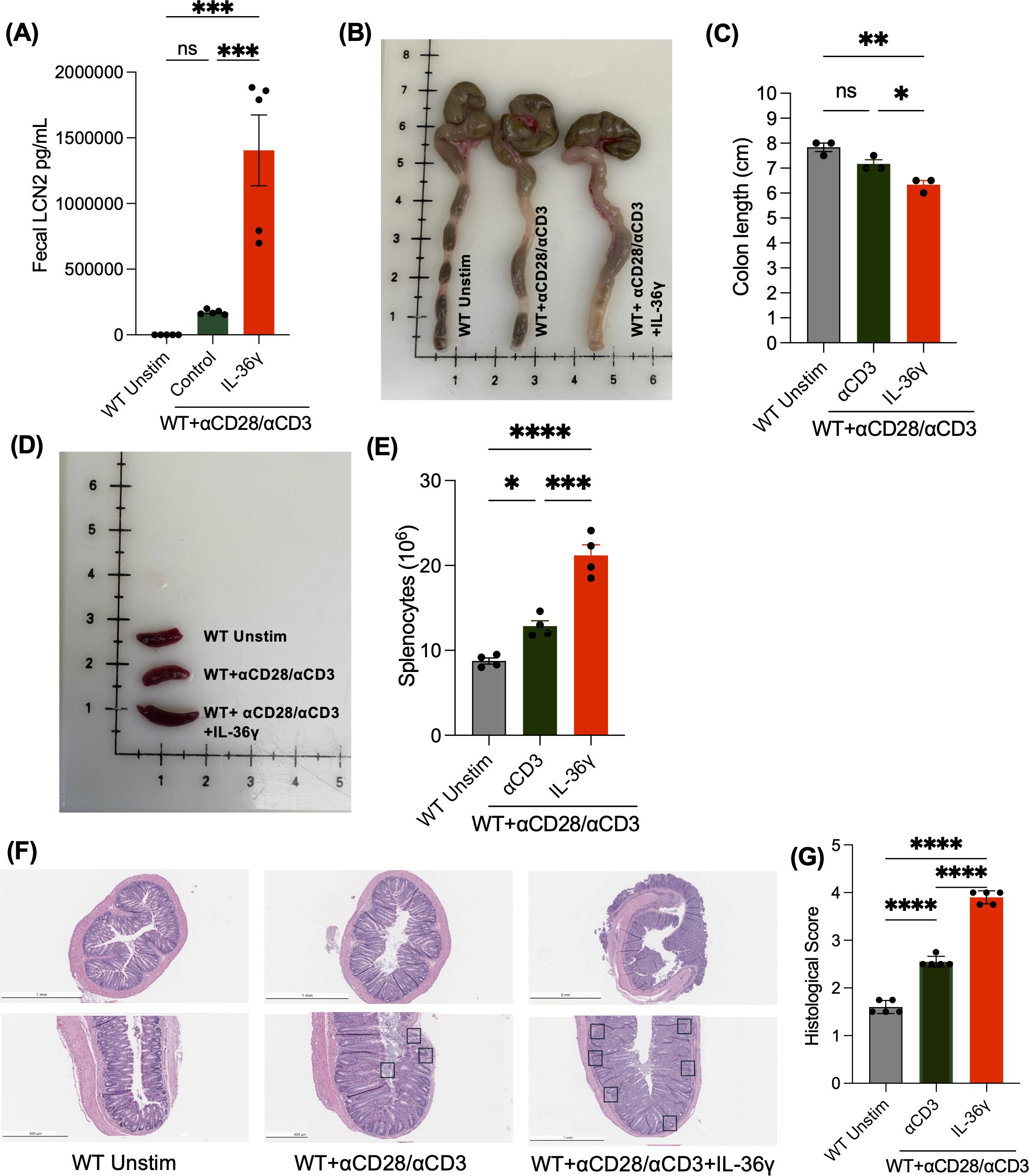 Composite image displaying experimental results in mice. Graph (A) shows fecal LCN2 levels for WT unstimulated, CD3 stimulated, and Il-36g treated groups, with significant differences noted. Photograph (B) depicts colons from the groups. Graph (C) illustrates colon lengths across treatments, with statistical significance indicated. Image (D) shows spleens from each treatment group. Graph (E) presents splenocyte counts, highlighting significant differences. Panel (F) provides histological sections of colons with varying treatments. Graph (G) reports histological scores, showing significant differences among groups.