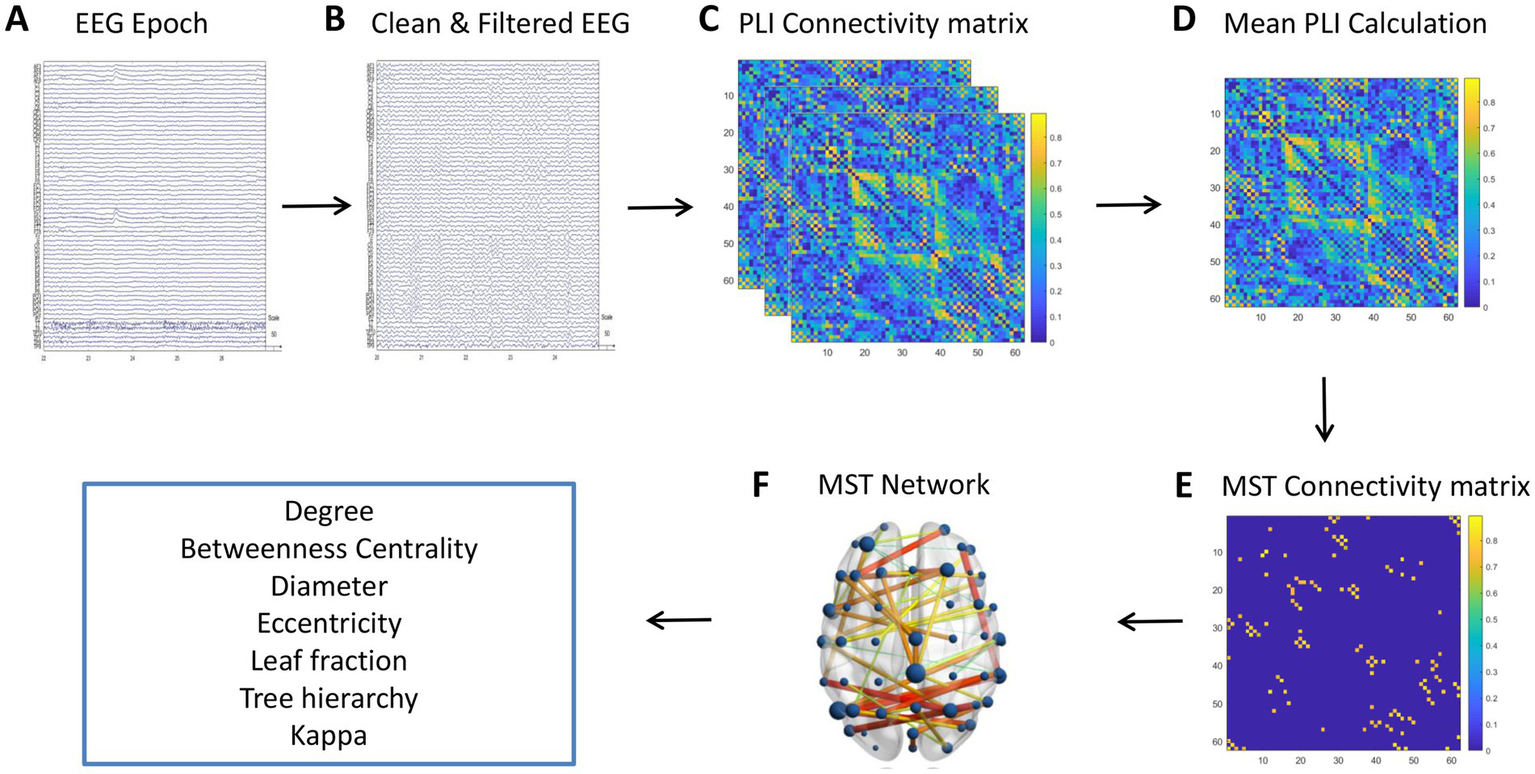 Flowchart of EEG data processing and analysis. Panel A shows an EEG epoch. Panel B displays the clean and filtered EEG. Panel C depicts the PLI connectivity matrix. Panel D is the mean PLI calculation. Panel E shows the MST connectivity matrix. Panel F illustrates the MST network with labeled metrics: degree, betweenness centrality, diameter, eccentricity, leaf fraction, tree hierarchy, and kappa.