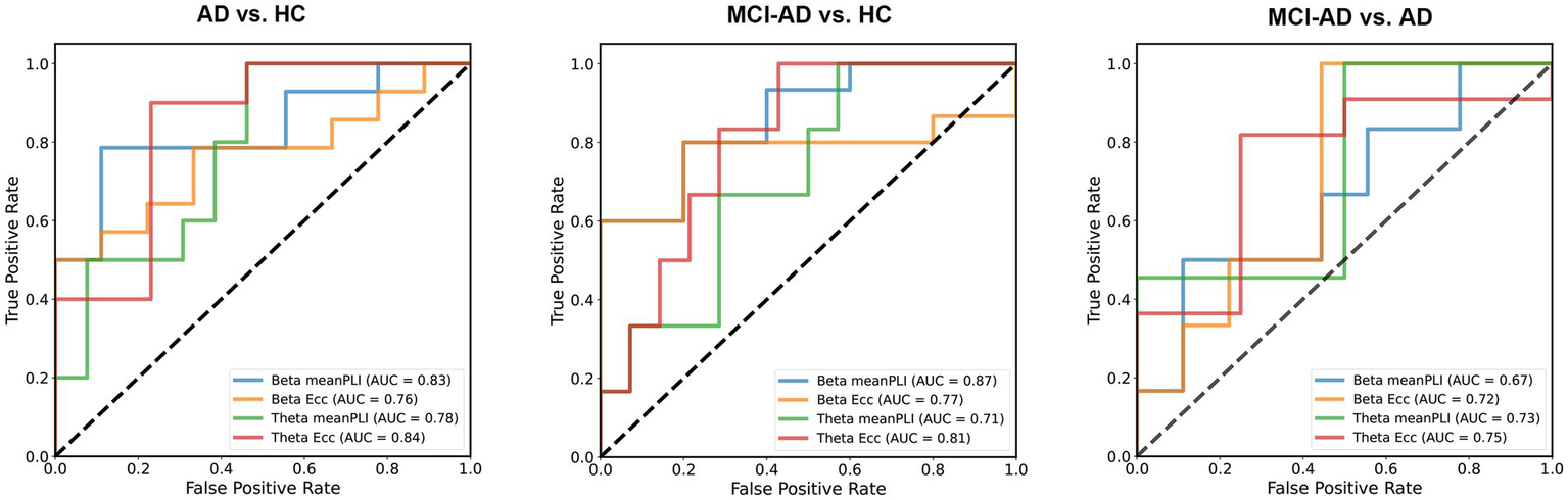Three ROC curves compare different conditions: AD vs. HC, MCI-AD vs. HC, and MCI-AD vs. AD. Each graph shows lines for Beta meanPLI, Beta Ecc, Theta meanPLI, and Theta Ecc, with AUC values indicating performance. A dashed line represents the random classifier baseline.