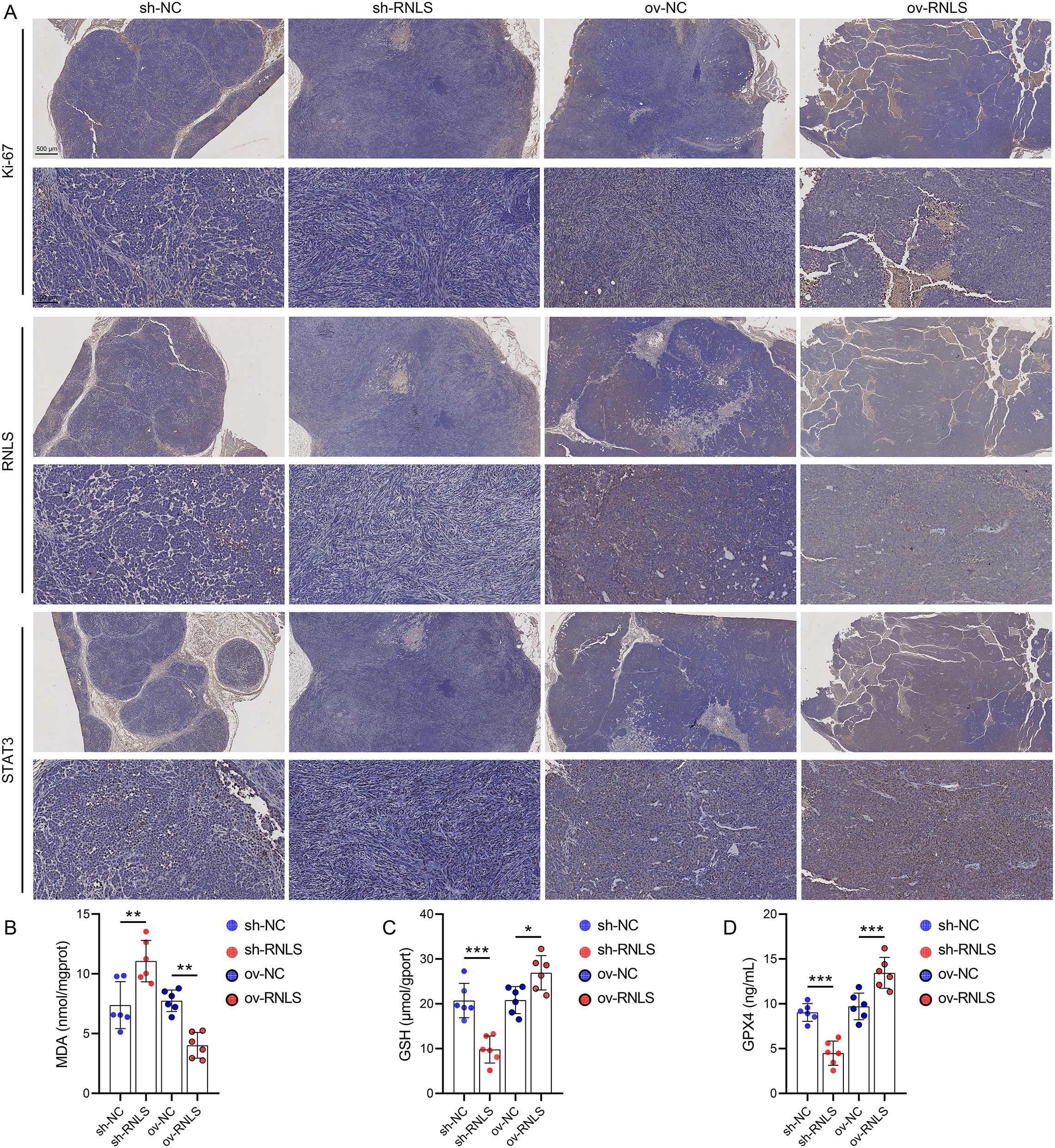 Panel A displays histological sections for Ki-67, RNLS, and STAT3 across four conditions: sh-NC, sh-RNLS, ov-NC, and ov-RNLS. Panels B, C, and D show bar graphs depicting MDA, GSH, and GPX4 levels, respectively, for the same conditions. Statistical significance is indicated with asterisks.